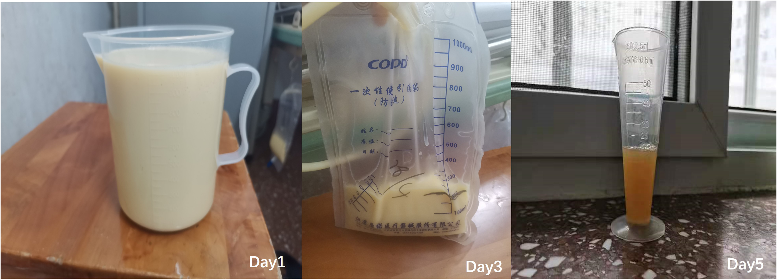 Three images show the progression of a liquid over five days. Day 1 features a creamy liquid in a transparent measuring jug. Day 3 shows a similar liquid in a plastic bag with volume markings. Day 5 depicts a smaller amount of cloudy orange liquid in a graduated cylinder.