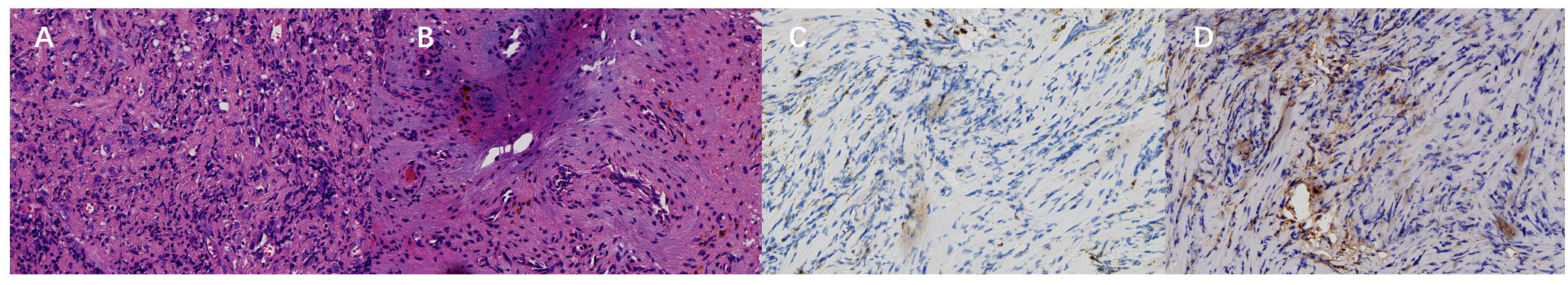 Histological slides showing tissue samples labeled A, B, C, and D. Sections A and B are stained in purple with dense cellular structures, while sections C and D appear blue with elongated, sparsely arranged cells.