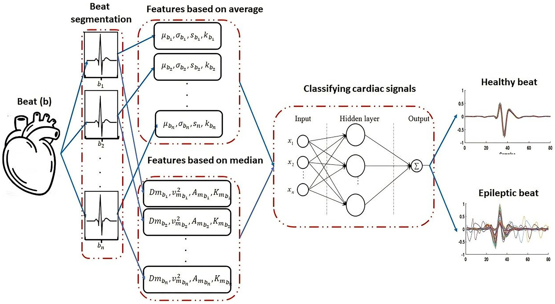 Flowchart showing the classification of cardiac signals. It begins with beat segmentation, extracting features based on averages and medians. These features are processed through a neural network. On the right, graphs of classified outputs show the differences between healthy and epileptic beats. A heart illustration represents the origin of the beats.