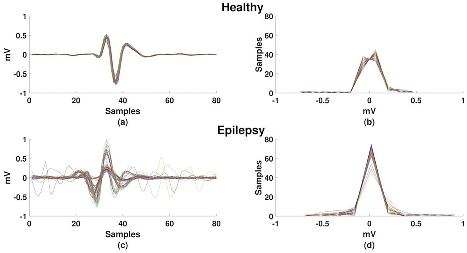 Graphs comparing signals from healthy and epilepsy-affected individuals. Top left (a) shows healthy signals over samples; top right (b) depicts healthy signals over millivolts. Bottom left (c) illustrates epilepsy signals over samples; bottom right (d) represents epilepsy signals over millivolts. Healthy signals are more consistent, while epilepsy signals vary more significantly.