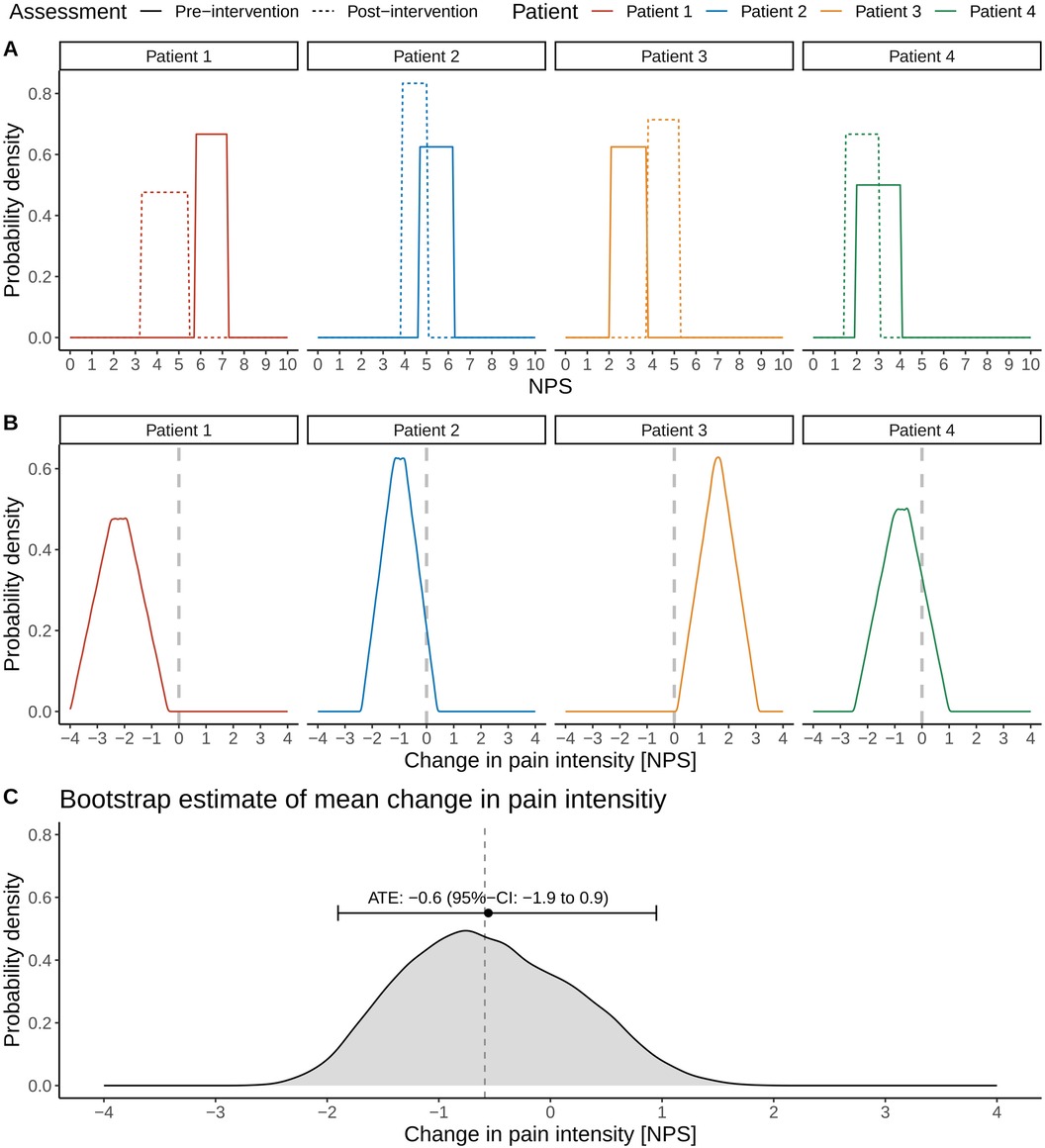 Panel A shows pre- and post-intervention probability density distributions of numerical pain scores (NPS) for four patients, with solid lines representing pre-intervention and dotted lines post-intervention. Panel B displays the distribution of change in pain intensity for each patient, centered around individual shifts in scores. Panel C presents a bootstrap estimate of the average treatment effect (ATE), with a mean change of -0.6 NPS and a 95% confidence interval ranging from −1.9 to 0.9, indicating uncertainty about the overall effect of the intervention across patients.