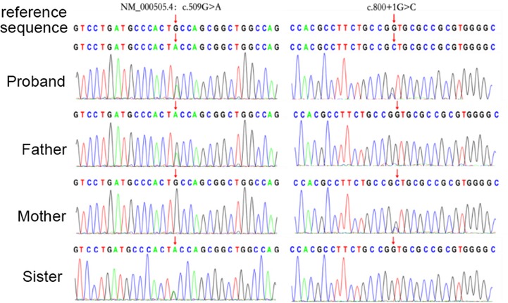 Electropherogram displaying DNA sequencing results for a reference sequence, a proband, father, mother, and sister. Variations are noted at c.509G>A and c.800+1G>C. Each person’s results show corresponding peaks and nucleotide sequences.