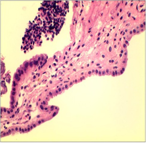 Microscopic image of a tissue section showing pink-stained elongated cells with dark nuclei. The cells form a structured layer, possibly epithelial tissue. A cluster of darker stained cells is visible in the upper left corner.