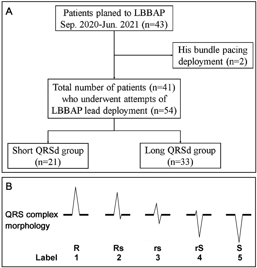 Flowchart and diagram illustrating LBBAP study and QRS complex morphologies. Panel A shows patients planned for LBBAP, including a group with His bundle pacing. The study divides patients into short and long QRS duration groups. Panel B displays QRS complex morphologies labeled R, Rs, rs, rS, S with corresponding numbers one to five.
