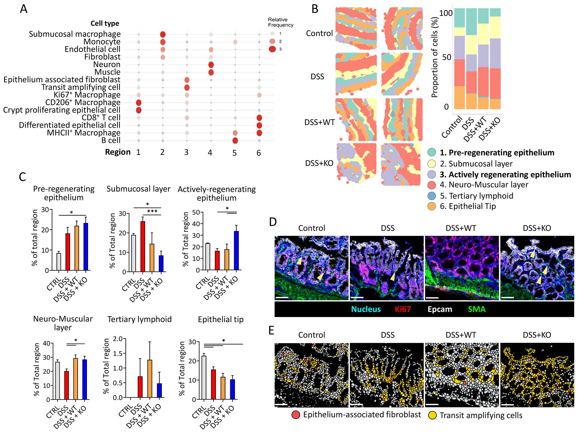 The image contains multiple panels illustrating cell type frequencies, tissue section analyses, and cell composition. Panel A shows a dot plot of relative frequencies of cell types across 6 regions. Panel B presents colored maps and a bar chart showing cell proportions in control and DSS-treated groups. Panel C contains bar graphs depicting the percentage of total regions for various layers. Panel D displays microscopic images highlighting nuclear and protein markers in different conditions. Panel E consists of images indicating epithelium-associated fibroblasts and transit-amplifying cells in tissue sections. Each panel assists in analyzing cellular and tissue characteristics.