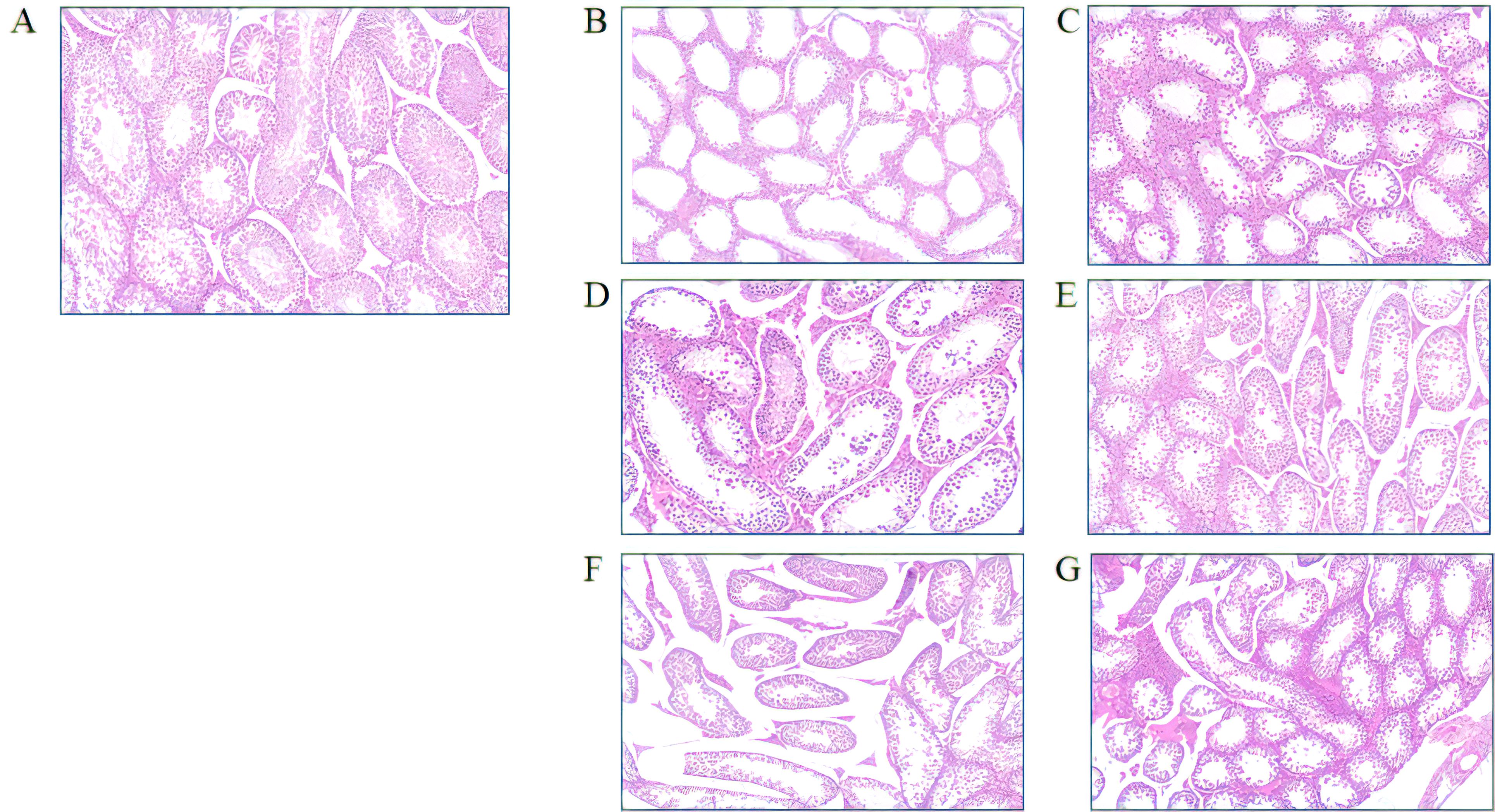 Microscopic images labeled A through G show various tissue samples. Each image displays distinct patterns and structures of cells, stained in pink and purple hues. Image A shows oval clusters. Image B has a honeycomb pattern. Image C displays a denser cellular configuration. Image D shows elongated structures. Image E has a mix of elongated and round shapes. Image F exhibits elongated cellular formations, and Image G shows circular clusters within fibrous tissue.
