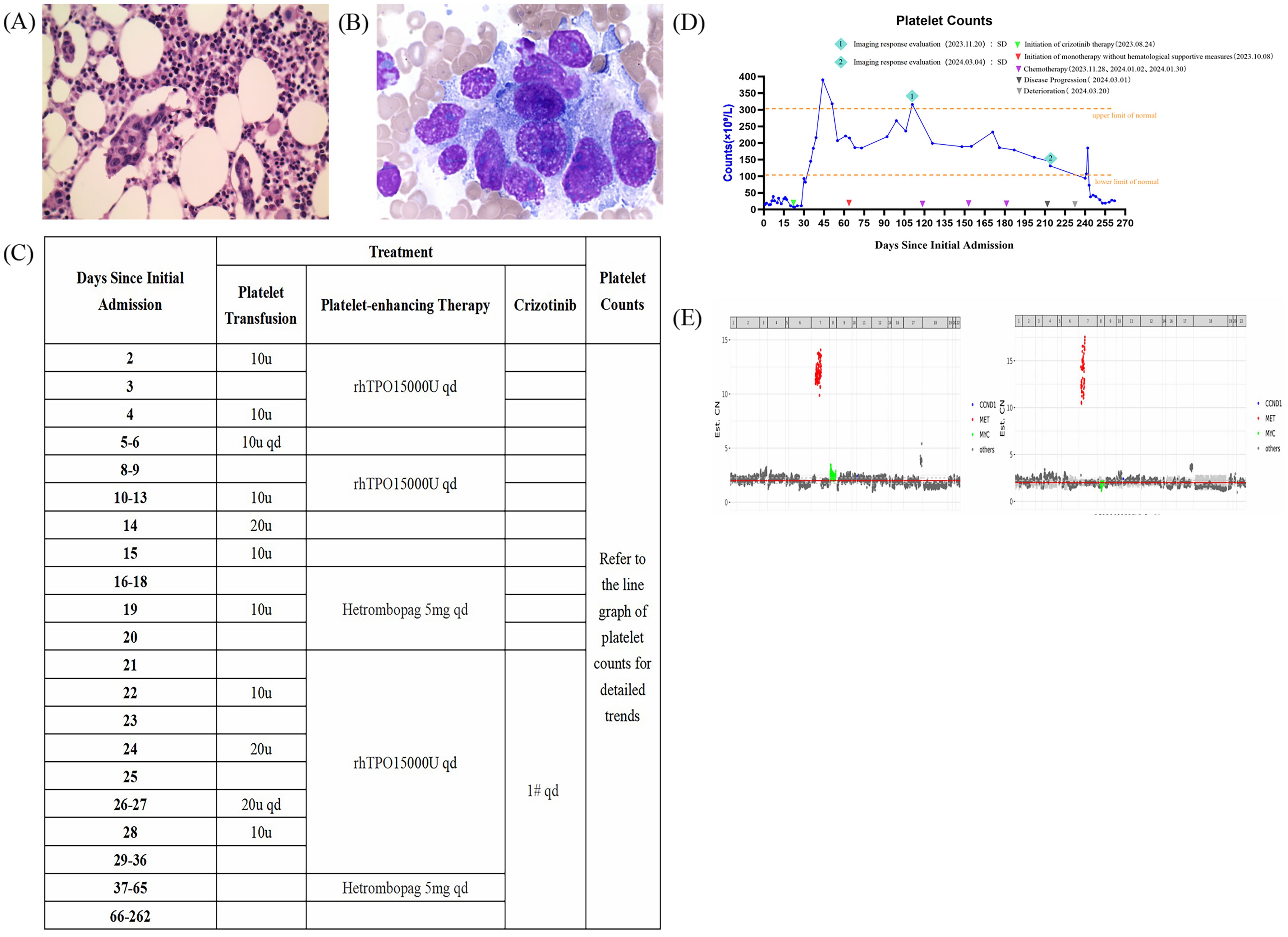 Panel (A) shows a microscopic image with purple-stained cells. Panel (B) displays a histological bone marrow section. Panel (C) is a table detailing platelet treatments and transfusions across days since admission. Panel (D) is a graph of platelet counts over time, with annotations for various treatments and evaluations. Panel (E) consists of two graphs plotting gene markers labeled CDKN2, MET, MRC, and others.