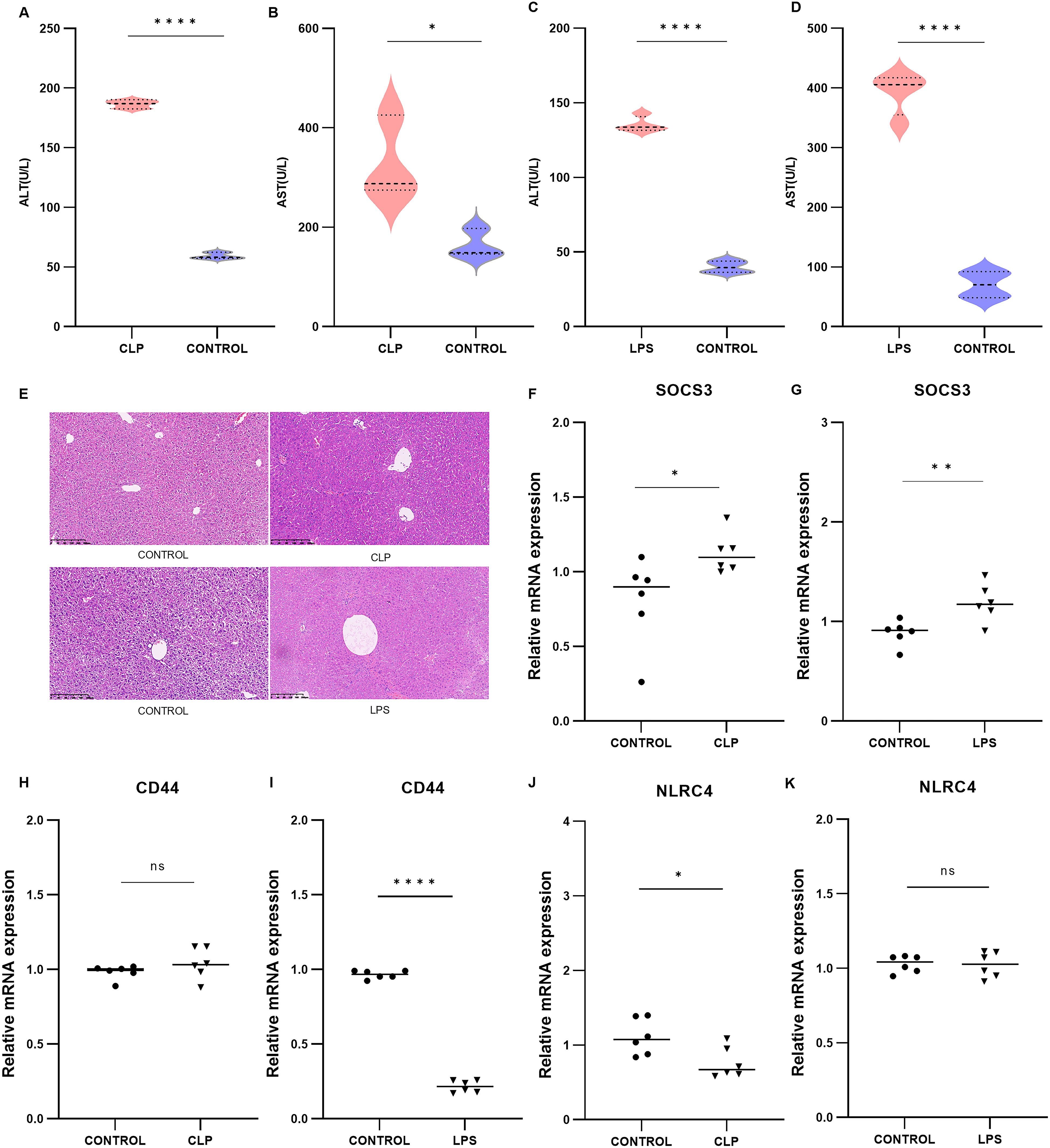 Violin plots A-D show ALT and AST levels comparing CLP and LPS groups to controls, with significant differences indicated. Panel E displays histological liver sections for control, CLP, and LPS groups. Panels F-K present dot plots of mRNA expression for SOCS3, CD44, and NLRC4, highlighting significant variations between experimental groups and controls.