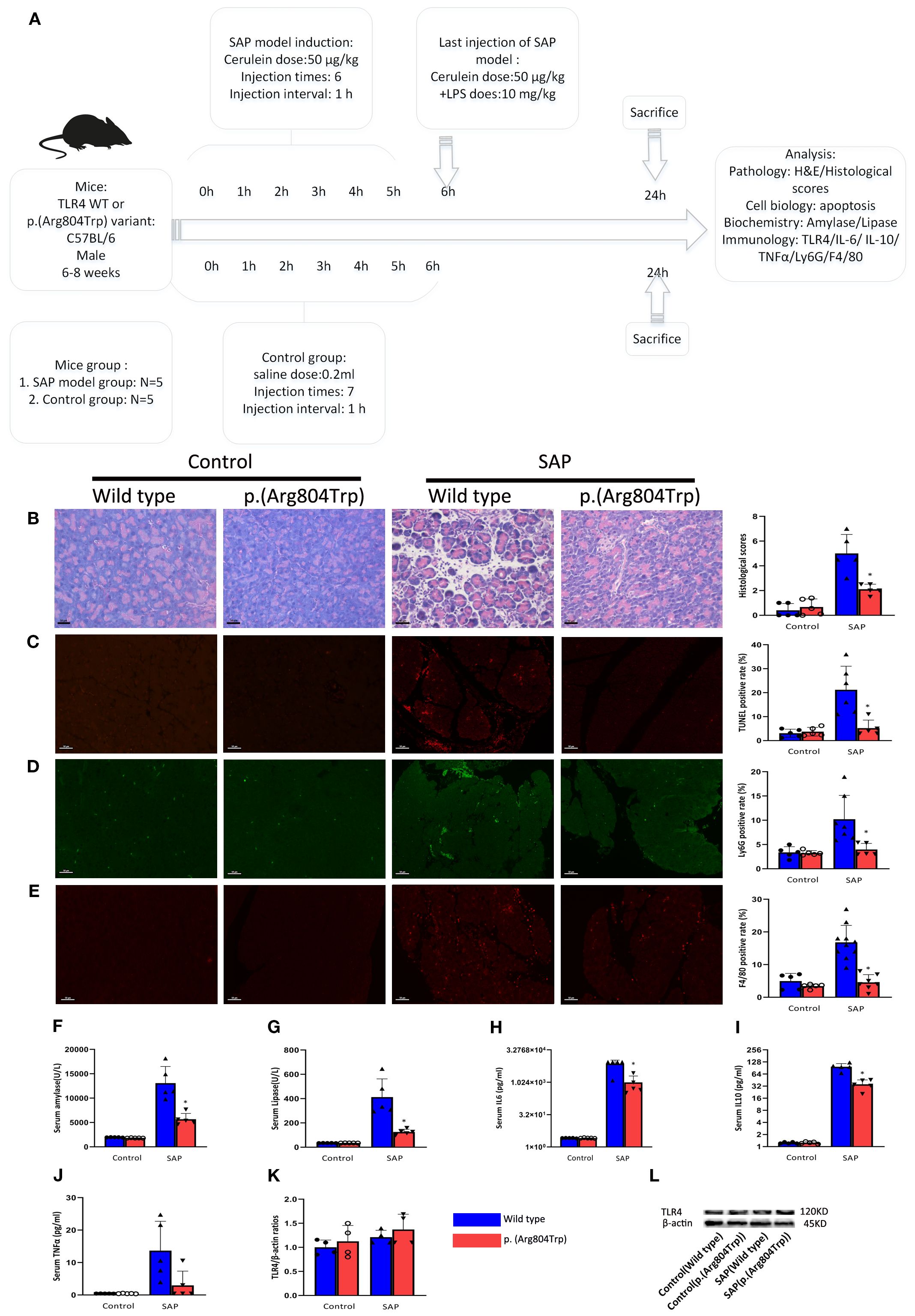Flowchart and experiment results from a study on mice grouped by TLR4 WT or p.(Arg804Trp) variant. Panels B to E show stained tissue samples under control and SAP conditions. Graphs F to K present biochemical data, comparing control and SAP groups in wild type and p.(Arg804Trp). Panel L displays Western blot analysis for TLR4 and β-actin. The images and data illustrate the differences in pathology, cell biology, biochemistry, and immunology between experimental and control groups.
