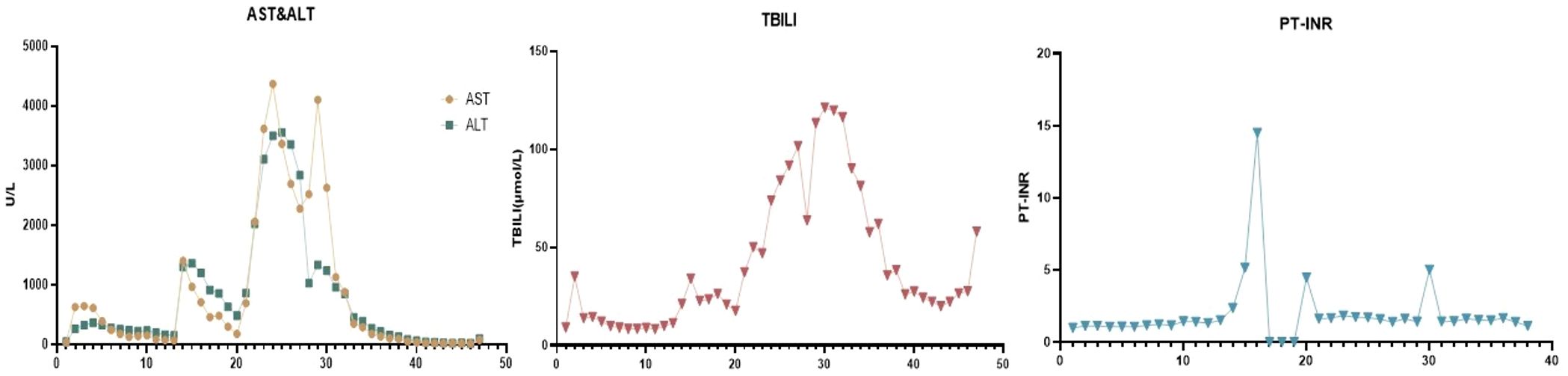 Three graphs showcasing medical data trends. The first graph shows AST and ALT levels (U/L) over time, with a peak around day 25. The second graph displays TBIL levels (µmol/L) with fluctuations, peaking around day 30. The third graph presents PT-INR values, spiking slightly around day 20.