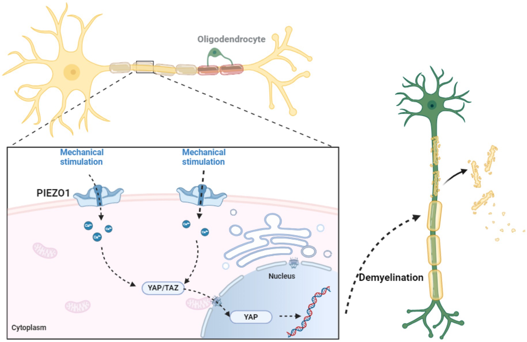Illustration showing a neural cell with oligodendrocytes and axons. A magnified section depicts PIEZO1 channels activated by mechanical stimulation, allowing calcium ions to enter the cytoplasm. This activates YAP/TAZ signaling pathways, leading to changes in the nucleus. On the right, a neuron displays demyelination, with myelin sheaths breaking down and detaching from the axon.