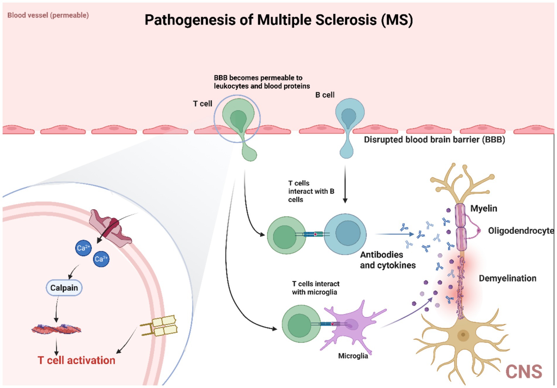 Diagram illustrating the pathogenesis of Multiple Sclerosis (MS). It shows a permeable blood-brain barrier (BBB) allowing T cells and B cells to enter the brain. T cells interact with B cells and microglia, leading to the release of antibodies and cytokines. This results in demyelination, targeting oligodendrocytes and myelin in the central nervous system (CNS). A detailed inset shows calcium ion involvement and calpain activation leading to T cell activation.