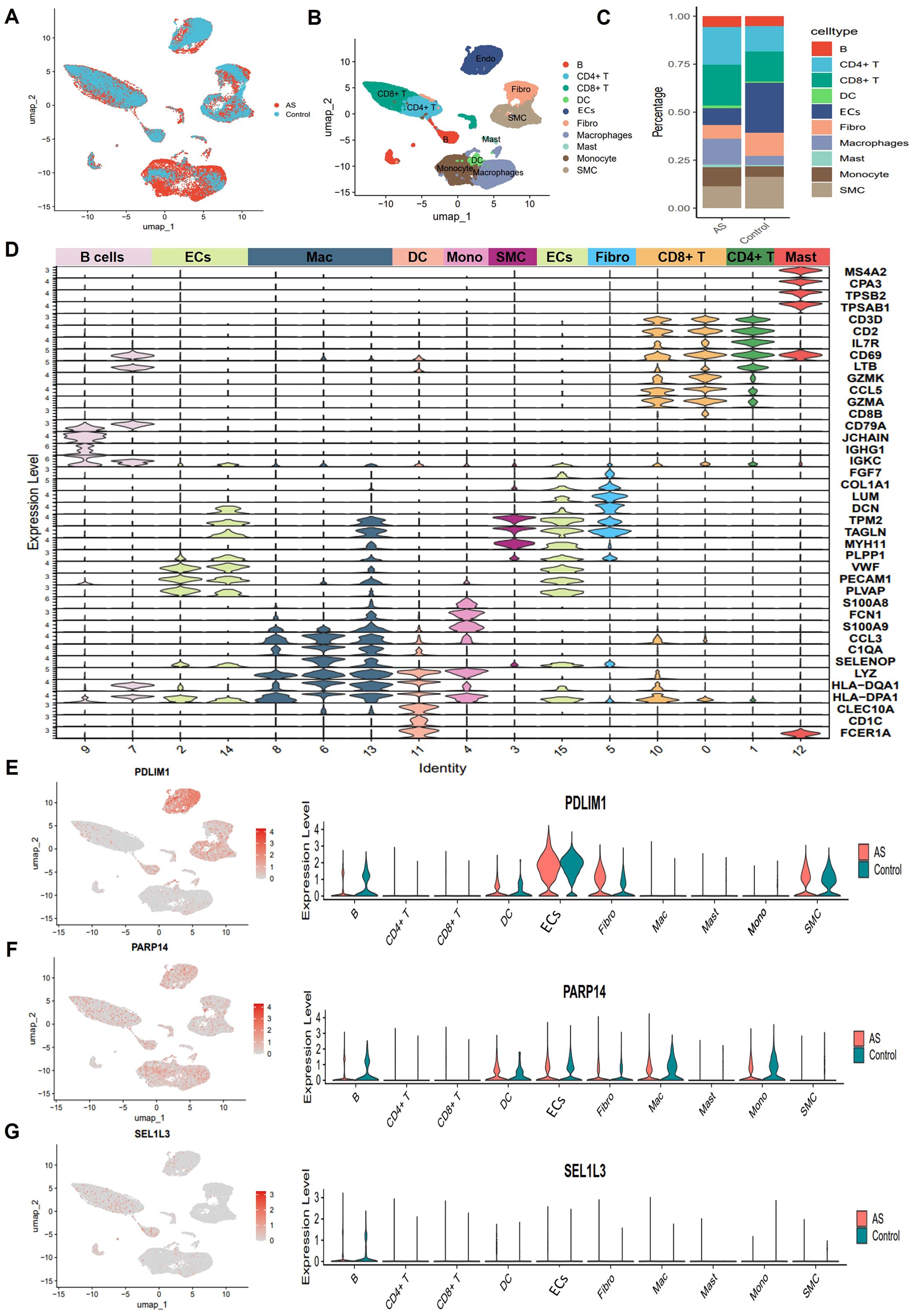 Scatter plots, bar graphs, and violin plots present cell type data analysis. Panels A-G depict UMAP clustering, cell type distribution, expression levels for specific genes (PDLIM1, PARP14, SEL1L3), and violin plots comparing conditions (AS vs. Control) for various cell types, including B cells, T cells, DCs, and others.