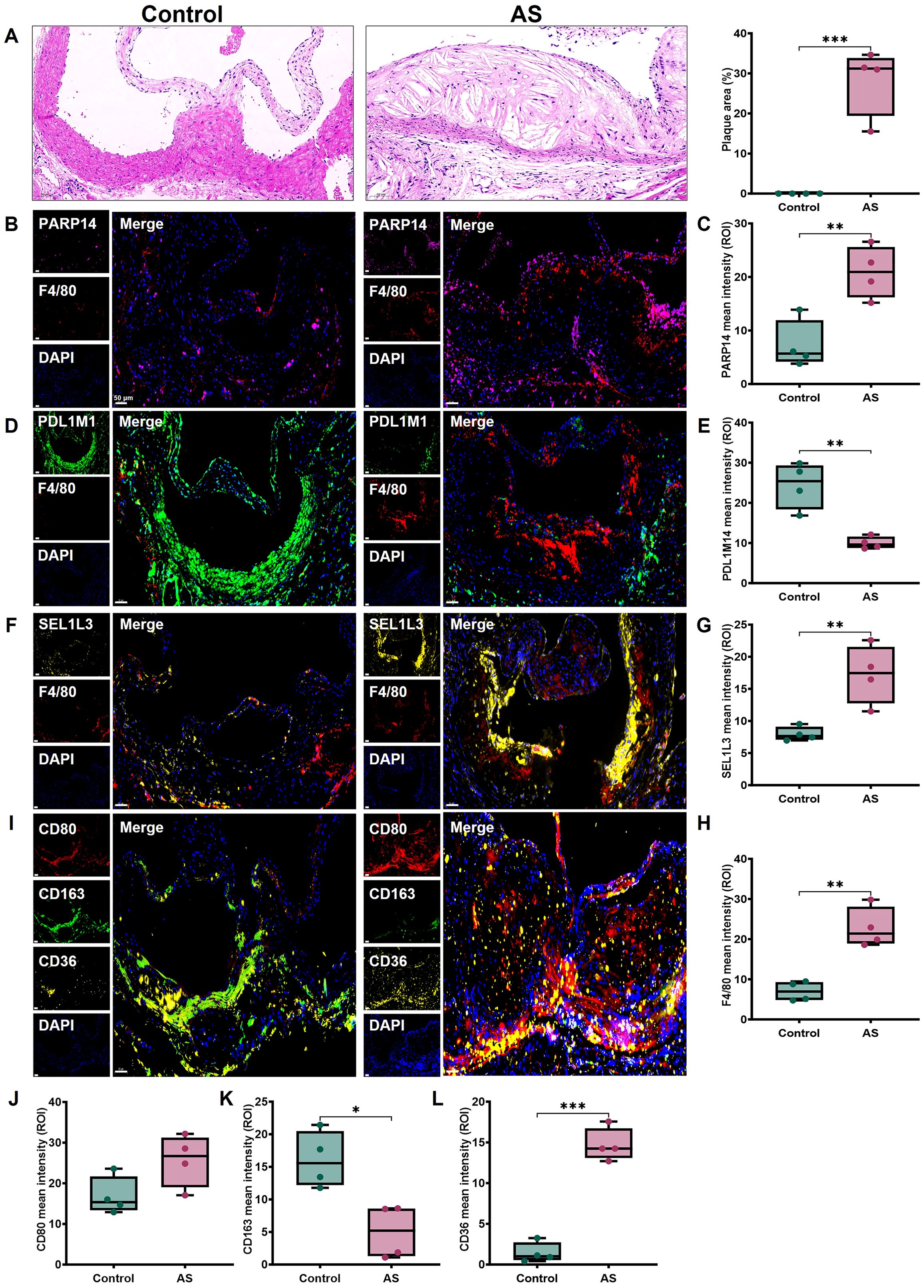 Histological and fluorescence microscopy images displaying the control and atherosclerosis (AS) conditions. Panel A shows hematoxylin and eosin-stained sections highlighting plaque formation in AS. Panels B, D, F, and I show fluorescence images with markers PARP14, PDL1M1, SEL1L3, and CD80 respectively. F4/80, CD163, and CD36 are shown with DAPI in some panels, illustrating immune cell presence and activity. Panels C, E, G, H, J, K, and L present box plots quantifying mean intensity differences between control and AS for various markers, indicating significant changes in AS conditions.