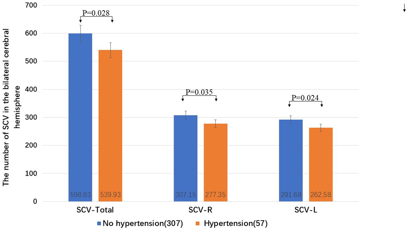Bar chart comparing the number of SCV (small cerebral vessels) in bilateral cerebral hemispheres between groups with no hypertension and hypertension. For SCV-Total, SCV-R, and SCV-L, the no hypertension group shows higher values than the hypertension group, with P-values of 0.028, 0.035, and 0.024 respectively. Blue bars represent no hypertension, while orange bars represent hypertension.