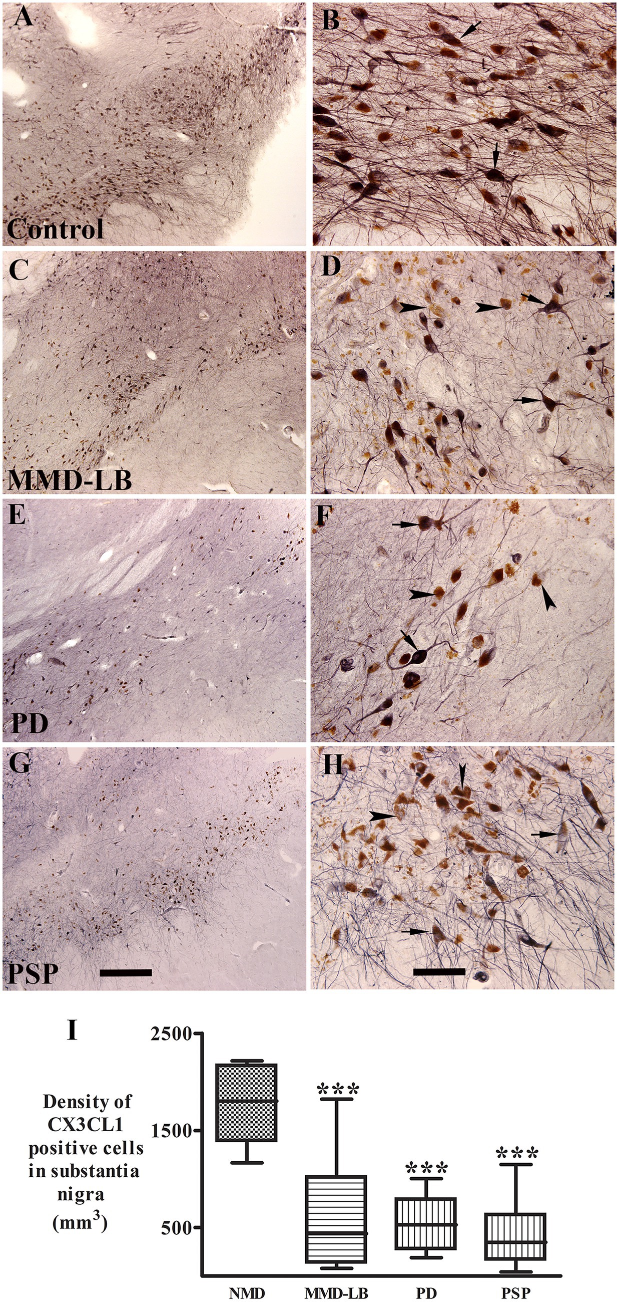 Histological analysis of the substantia nigra, comparing control and neurological disorder groups: Control (A, B), MMD-LB (C, D), PD (E, F), PSP (G, H). Images show variations in cell density, indicated by brown-stained cells. Arrows highlight specific cell features. Chart (I) displays the density of CX3CL1 positive cells per cubic millimeter, with significant differences marked by asterisks for MMD-LB, PD, and PSP compared to control.