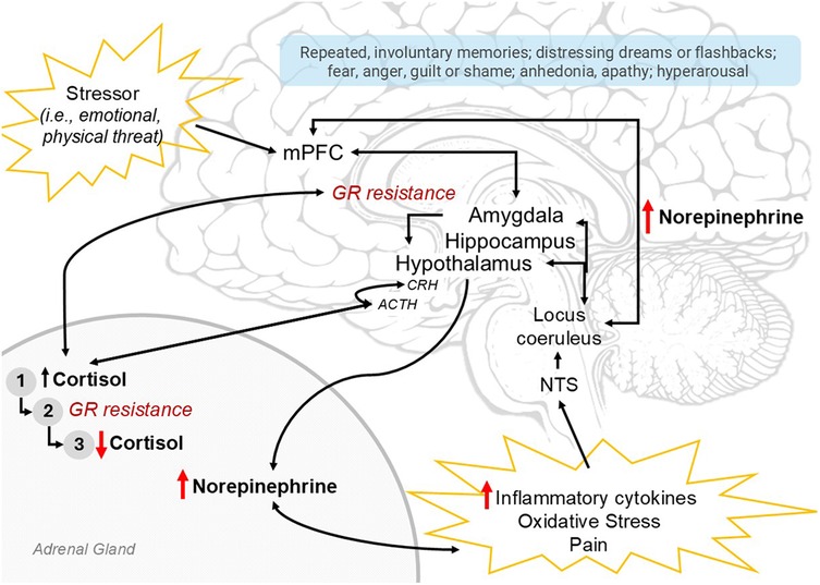 Diagram illustrating the stress response and endophenotype of post-traumatic stress disorder, or PTSD. A stressor, either perceived psychologically or physiologically from the body (such as inflammation) is shown to activate stress systems in the brain. These include the medial prefrontal cortex, amygdala, hippocampus, hypothalamus. This leads to increased norepinephrine and cortisol release. Sustained cortisol release is shown to cause resistance to cortisol-sensing receptors, leading to increasing cortisol and ultimately depletion. The final neurophenotype of PTSD is shown with red arrows, showing HPA-axis dysregulation, low cortisol, high norepinephrine and high inflammation. A blue box shows related PTSD clinical symptoms.