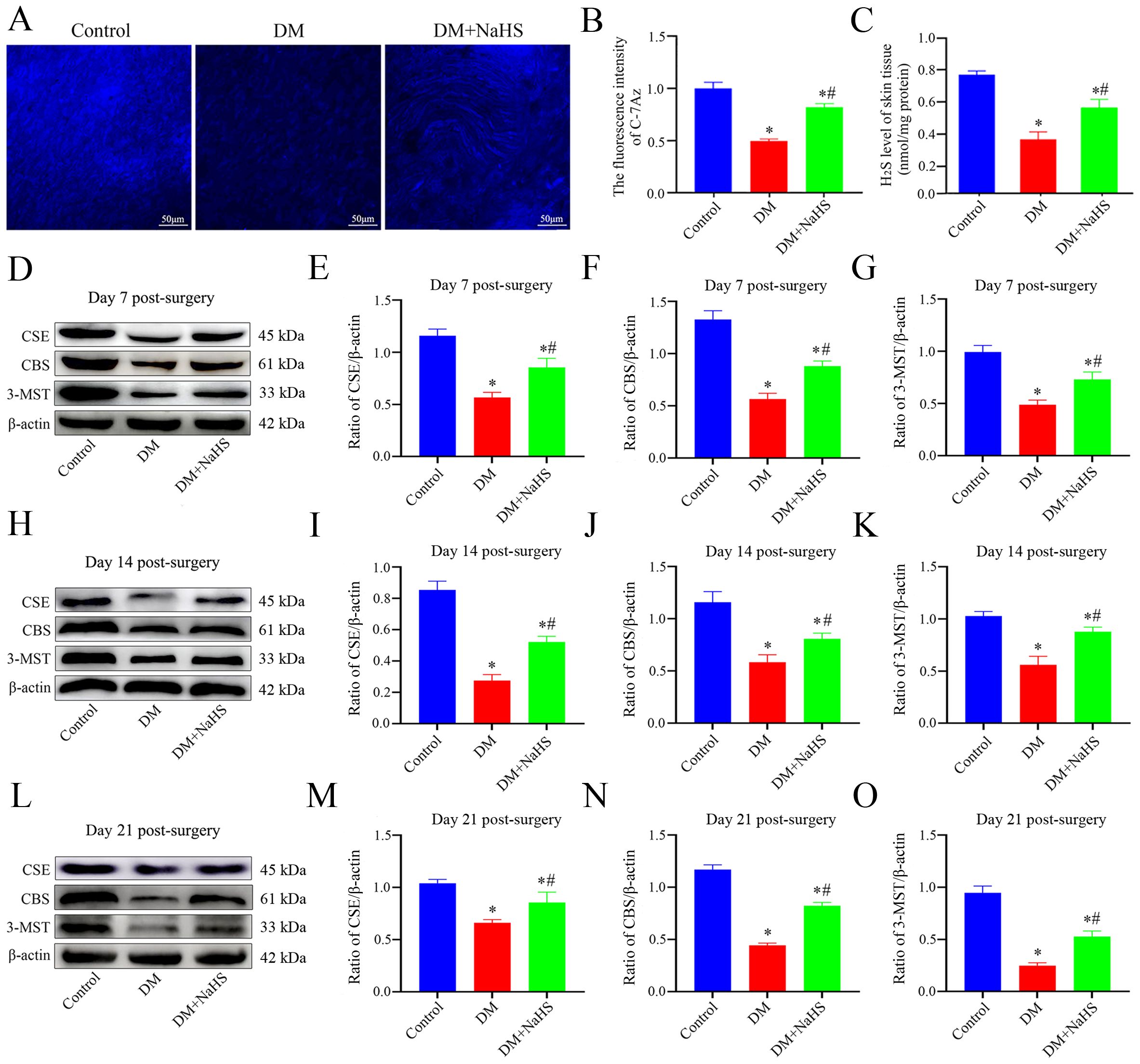 Panel A shows fluorescence images of skin tissues under control, DM, and DM+NaHS conditions. Panel B and C are bar graphs depicting fluorescence intensity of C7AZ and levels of H2S in skin tissues, respectively. Panels D, E, and F show protein expression levels through Western blot analysis for CSE, CBS, and 3-MST at different postoperative days, accompanied by bar graphs comparing expression levels across control, DM, and DM+NaHS groups. Significant differences are marked with symbols.