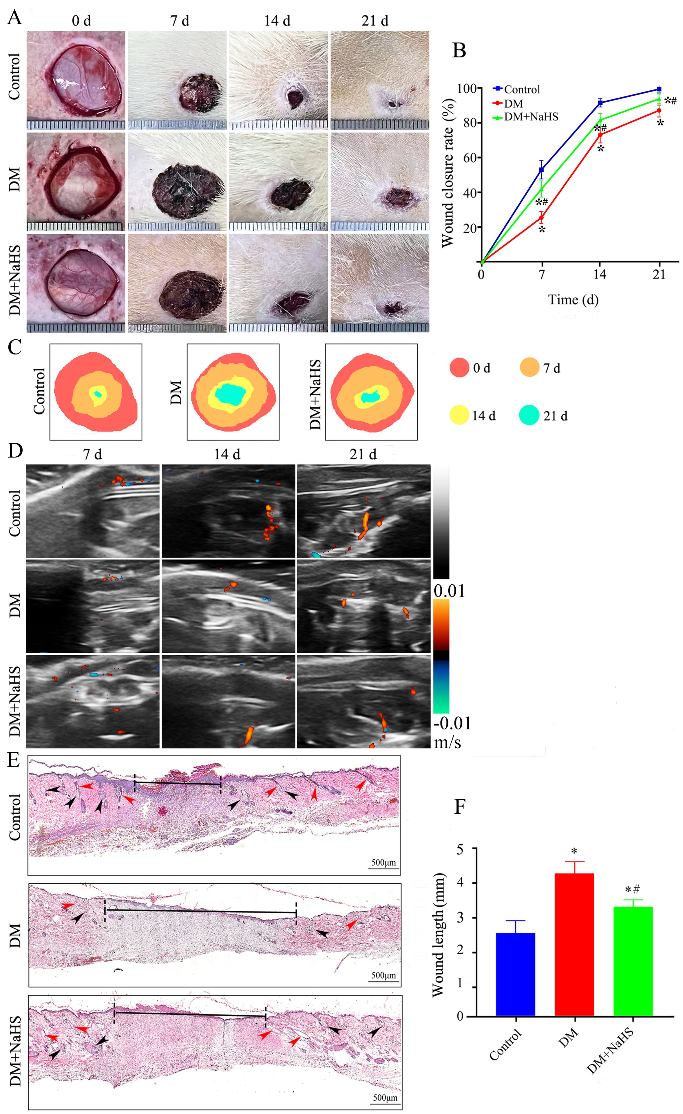 Panel A shows wound healing progression in control, DM, and DM+NaHS groups over 21 days. Panel B is a line graph of wound closure rates, with control showing the fastest healing. Panel C illustrates wound areas at different time points with color-coded visuals. Panel D presents ultrasound images displaying tissue changes over time. Panel E depicts histological sections of wounds, highlighting collagen deposition. Panel F is a bar graph comparing wound length, showing the DM group with the longest wounds and DM+NaHS with shorter lengths than DM.