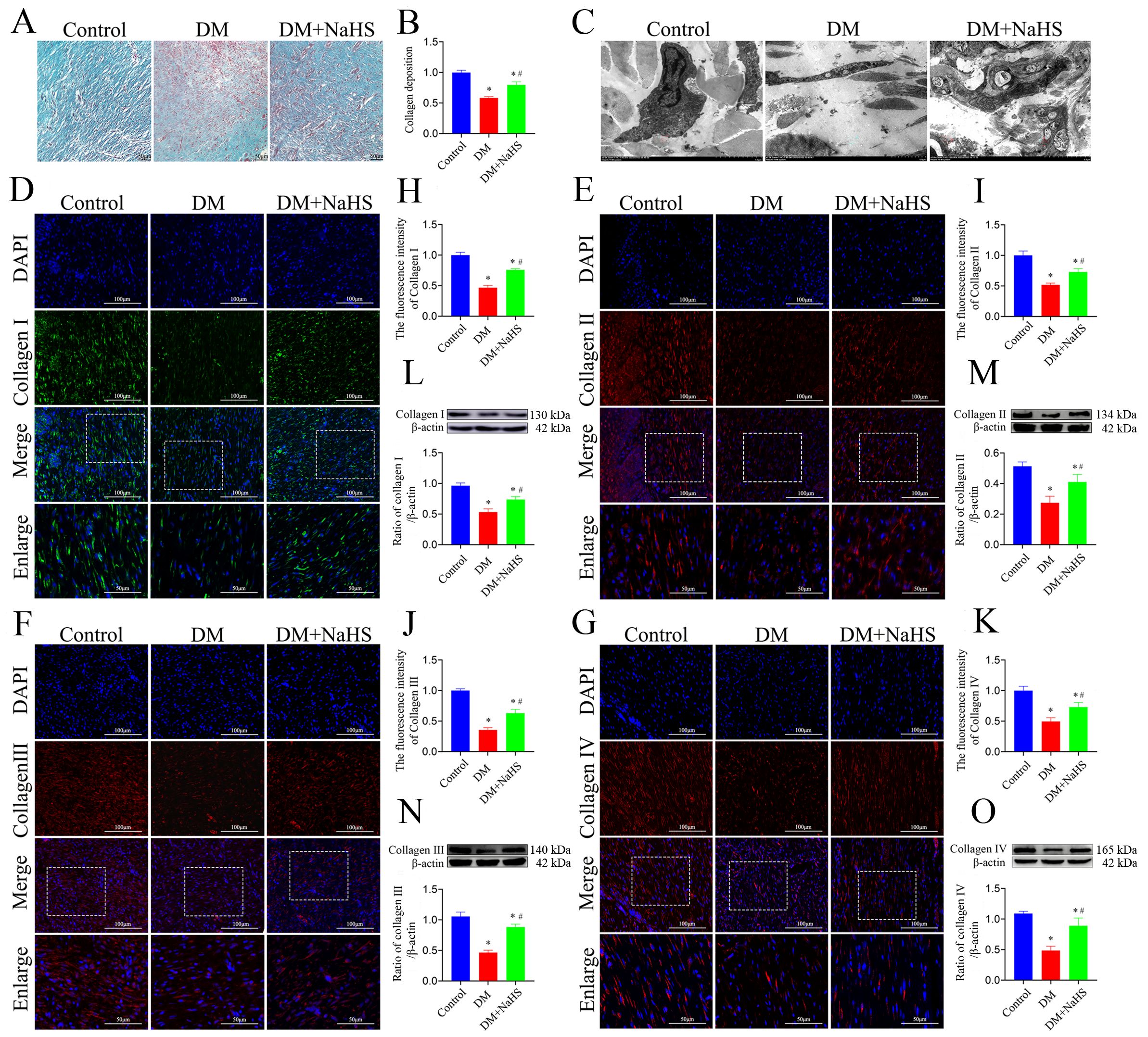 Histological and molecular analysis panels present the effects of different treatments on collagen expression in tissues. Panel A shows stained tissue sections from control, DM, and DM+NaHS groups. Panel B provides a bar graph for collagen deposition. Panel C features electron microscopy images. Panels D-G depict immunofluorescence images for different types of collagen (I, II, III, IV) with corresponding fluorescence intensity bar graphs in panels H-K. Panels L-O display Western blot results and relative protein expression graphs. Each panel contrasts control, DM, and DM+NaHS groups.