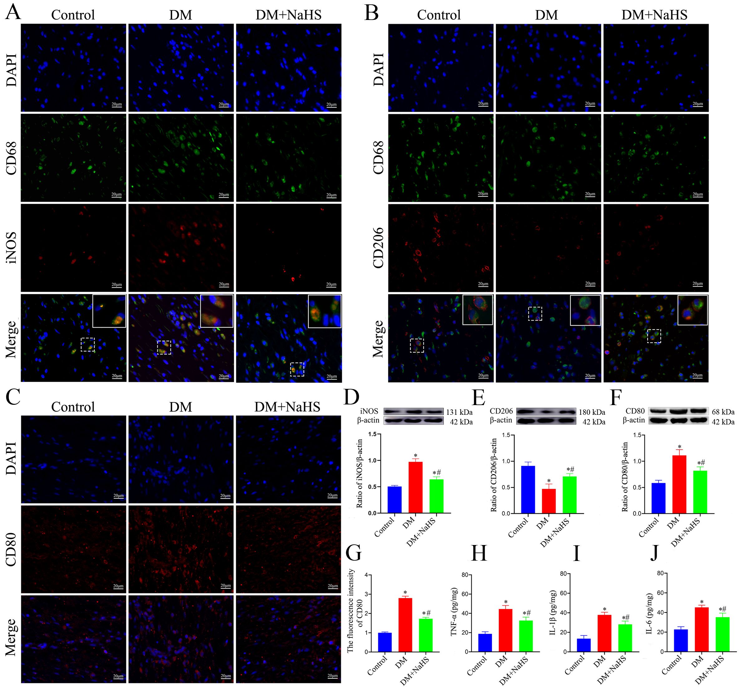 Fluorescent microscopy images and bar graphs depicting the effects of different treatments: Control, DM, and DM+NaHS. Panels A, B, and C show stained sections with DAPI (blue), and markers such as CD68, iNOS, CD206, and CD80 in various colors, along with merged views. Panels D, E, and F display Western blot analyses of iNOS, CD206, and CD80 with their corresponding bar graphs showing relative expression. Panels G, H, I, and J present bar graphs illustrating fluorescence intensity and levels of TNF-α, IL-1β, and IL-6 under different conditions.