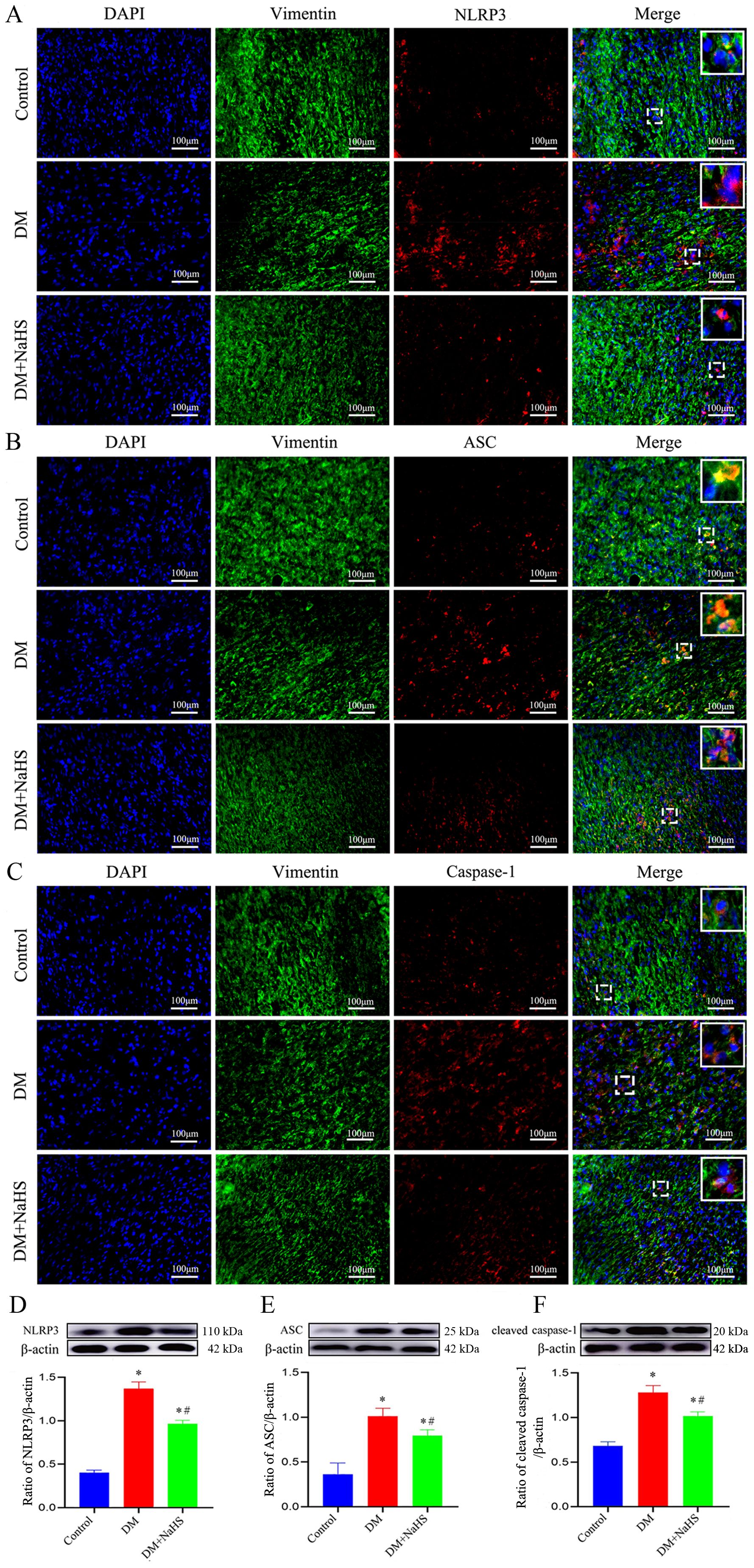 Fluorescent images and bar graphs illustrating the effects of three conditions: Control, DM, and DM plus NaHS, on protein expression in tissues or cells. Panels A, B, and C display images stained with DAPI, Vimentin, NLRP3, ASC, and Caspase-1, followed by merged images. Images are labeled with a scale of 100 micrometers. Panels D, E, and F show bar graphs with Western blot results, depicting relative protein expression levels for NLRP3, ASC, and cleaved Caspase-1 across the conditions. Statistical significance is indicated by asterisks and hash symbols.