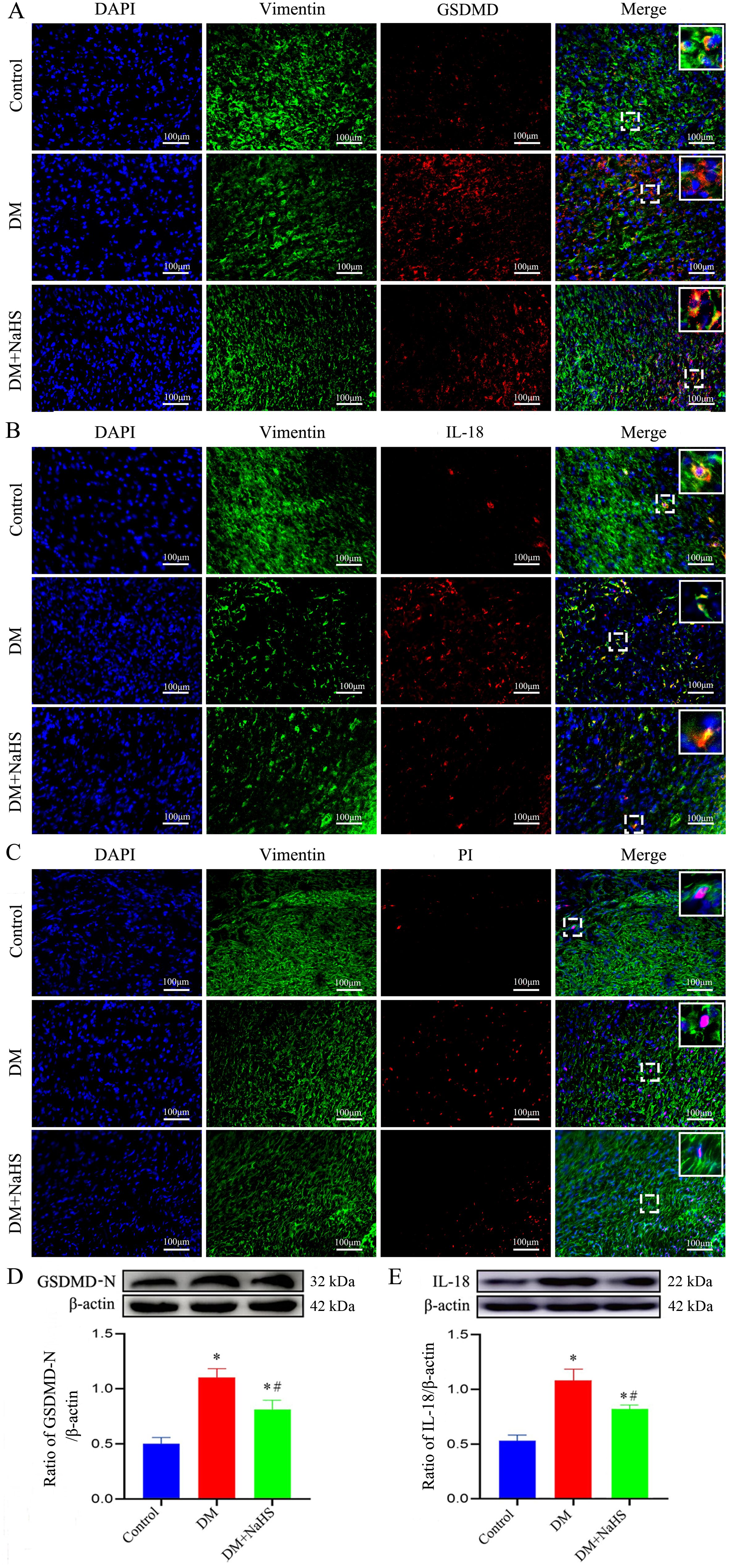 Microscopy images display the expression of proteins in control, DM, and DM+NaHS groups, stained with DAPI (blue), Vimentin (green), GSDMD, IL-18, or PI (red), and merged colors. Insets highlight key areas. Two bar graphs and Western blots show relative protein expression levels of GSDMD-N and IL-18, with significant differences marked in the graphs.