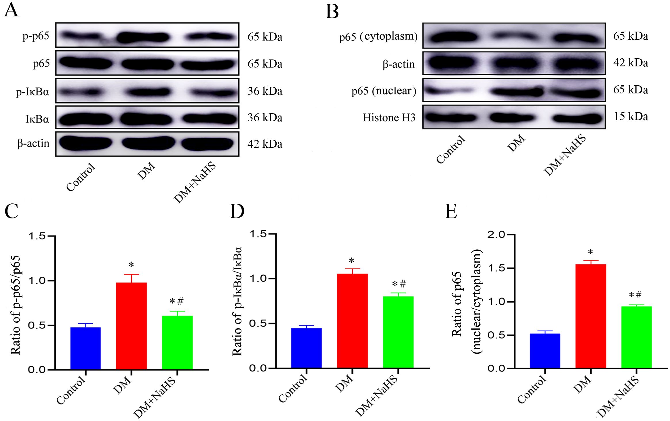 (A) Western blotting of protein expressions in control, DM, and DM+NaHS groups for p-p65, p65, p-IκBα, IκBα, and β-actin. (B) Western blotting of p65 in cytoplasm and nucleus with β-actin and Histone H3. (C-E) Bar graphs of relative protein levels: p-p65/p65, p-IκBα/IκBα, and p65 nuclear/cytoplasm, showing significant changes in DM and DM+NaHS groups compared to control. Experimental groups are color-coded: blue (control), red (DM), and green (DM+NaHS).