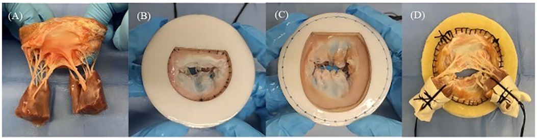 Four-panel image providing a step-by-step view of a medical procedure. Panel A shows a heart valve with surrounding tissue. Panels B and C depict the valve positioned on circular supports, highlighting different stages of preparation. Panel D displays the final assembly with the valve secured and stitched, indicating completion of the procedure. Each panel shows blue-gloved hands for manipulation.