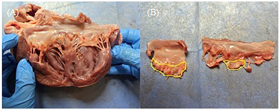 Two images labeled A and B show dissected heart tissue. In image A, gloved hands hold a section displaying internal heart structures. Image B displays two separate tissue sections with yellow outlines indicating specific areas of interest.