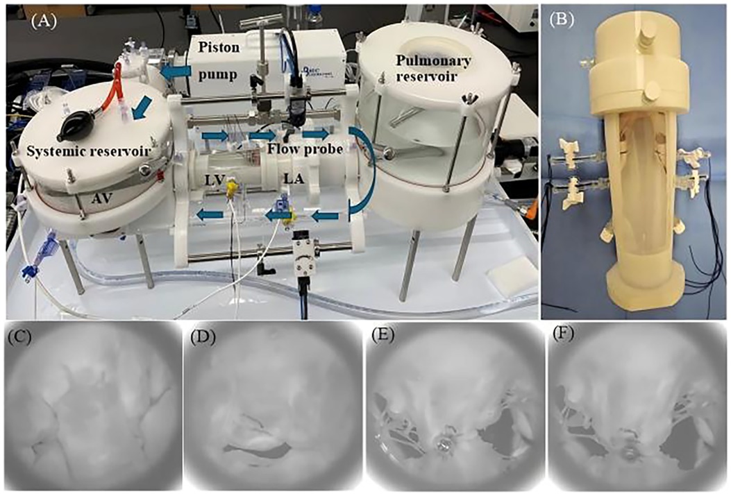 (A) A heart flow simulation device with labeled components: systemic reservoir, piston pump, pulmonary reservoir, LV, and LA. (B) A cylindrical chamber with attached tubes and valves. (C-F) presents highspeed camera images.