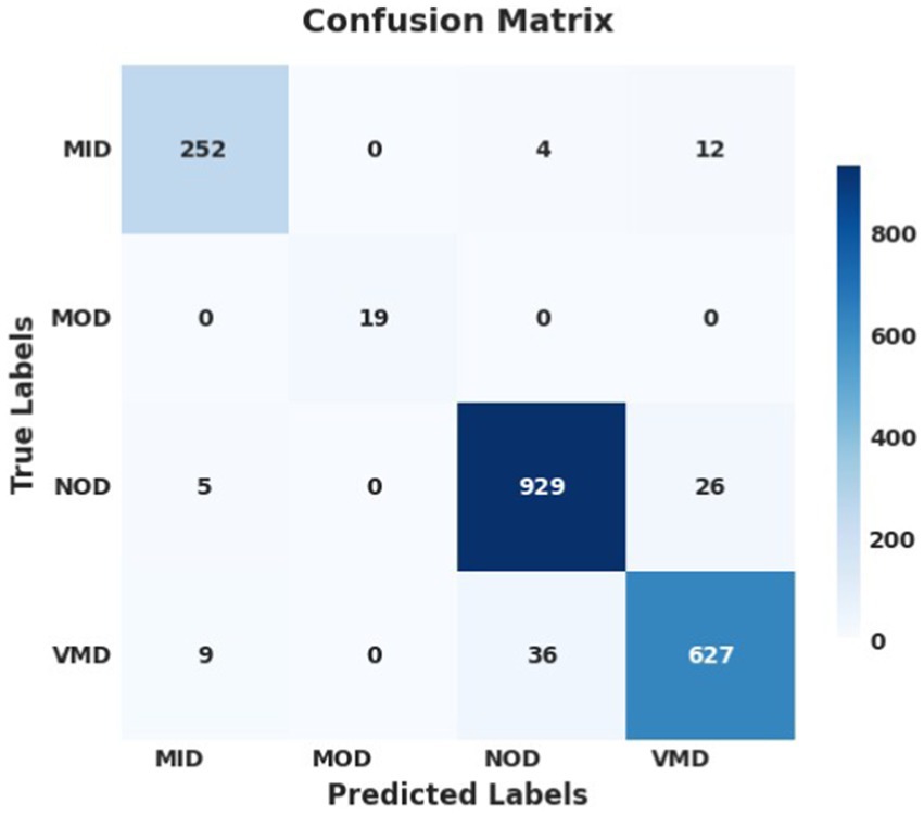 Confusion matrix for a classification model with categories: MID, MOD, NOD, and VMD. True and predicted labels are compared. Most samples are correctly classified with high accuracy across all classes. Some misclassifications occur, mainly between NOD and VMD.