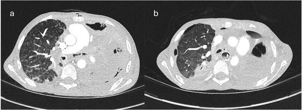 CT scans labeled as \