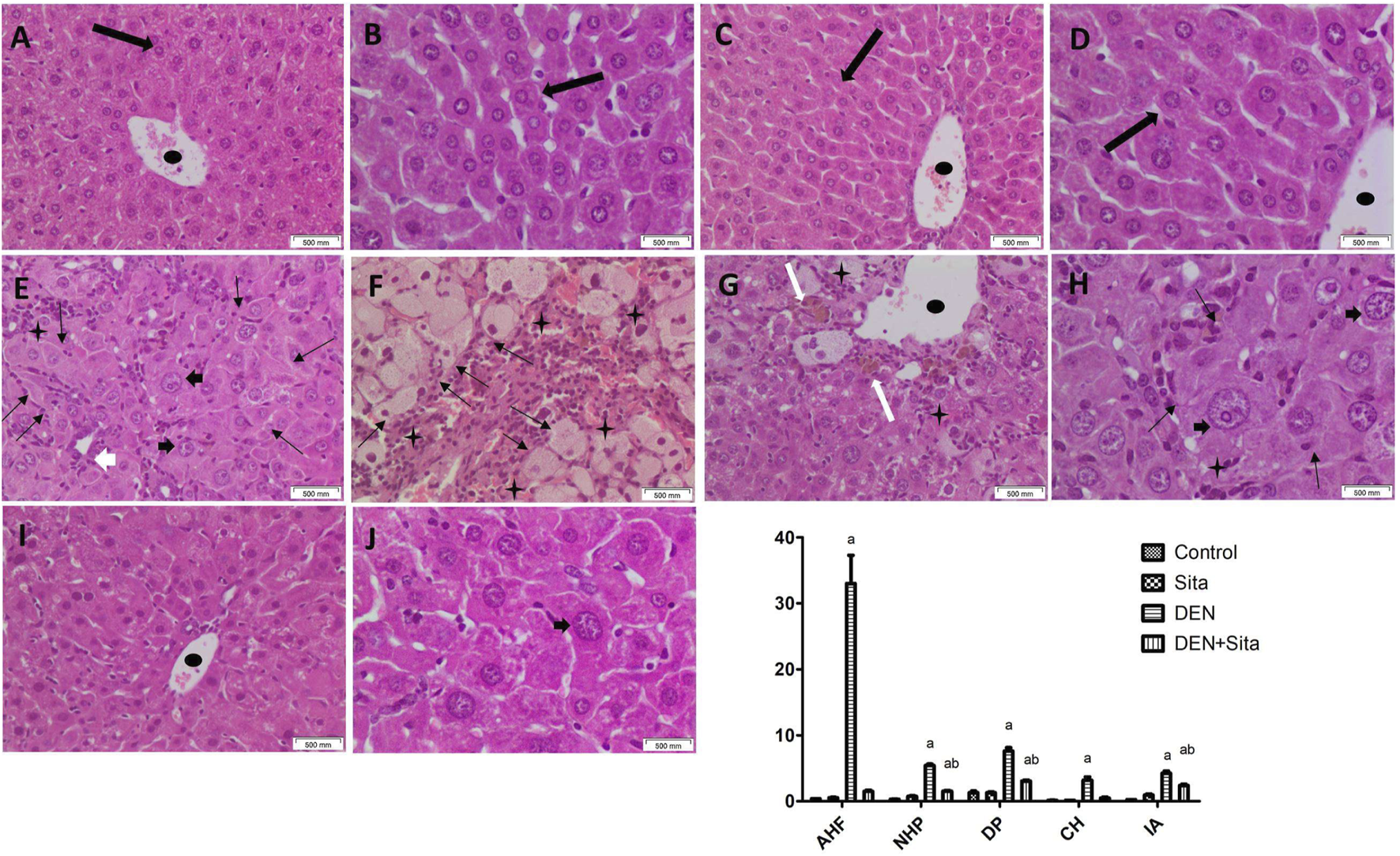 From A–K show liver tissue sections stained with hematoxylin and eosin, demonstrating various cellular changes and features, such as inflammation, necrosis, and cellular alterations. Black and white arrows indicate specific cell structures or pathological changes. A bar graph is included, comparing different treatments: Control, Sita, DEN, and DEN+Sita, across parameters like AHF, NHP, DP, CH, and IA, with statistical annotations.