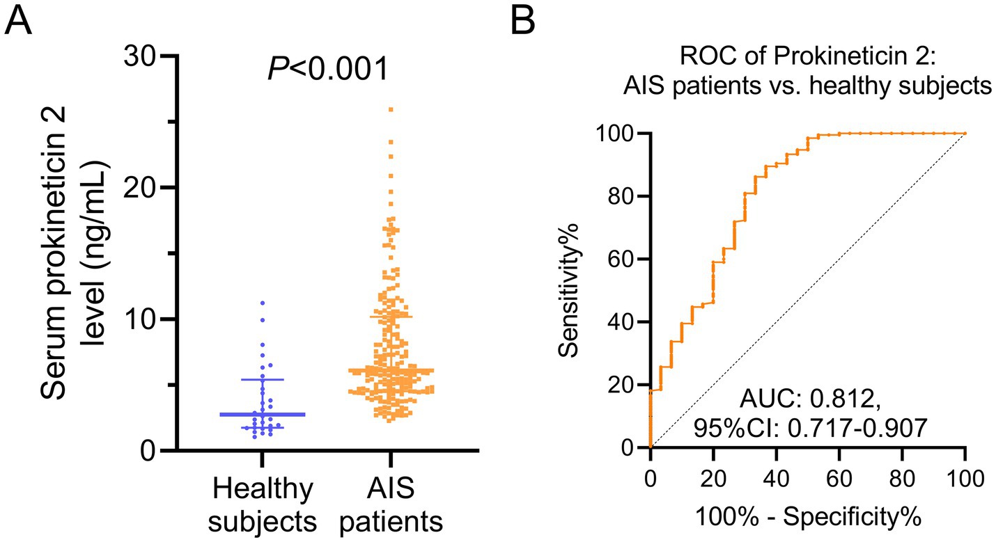 Graph A is a scatter plot comparing serum prokineticin 2 levels in healthy subjects and AIS patients, with higher levels in AIS patients, showing a significant difference (P<0.001). Graph B is an ROC curve for prokineticin 2 differentiating AIS patients from healthy subjects, with an AUC of 0.812 and a 95% confidence interval of 0.717-0.907, indicating good diagnostic ability.