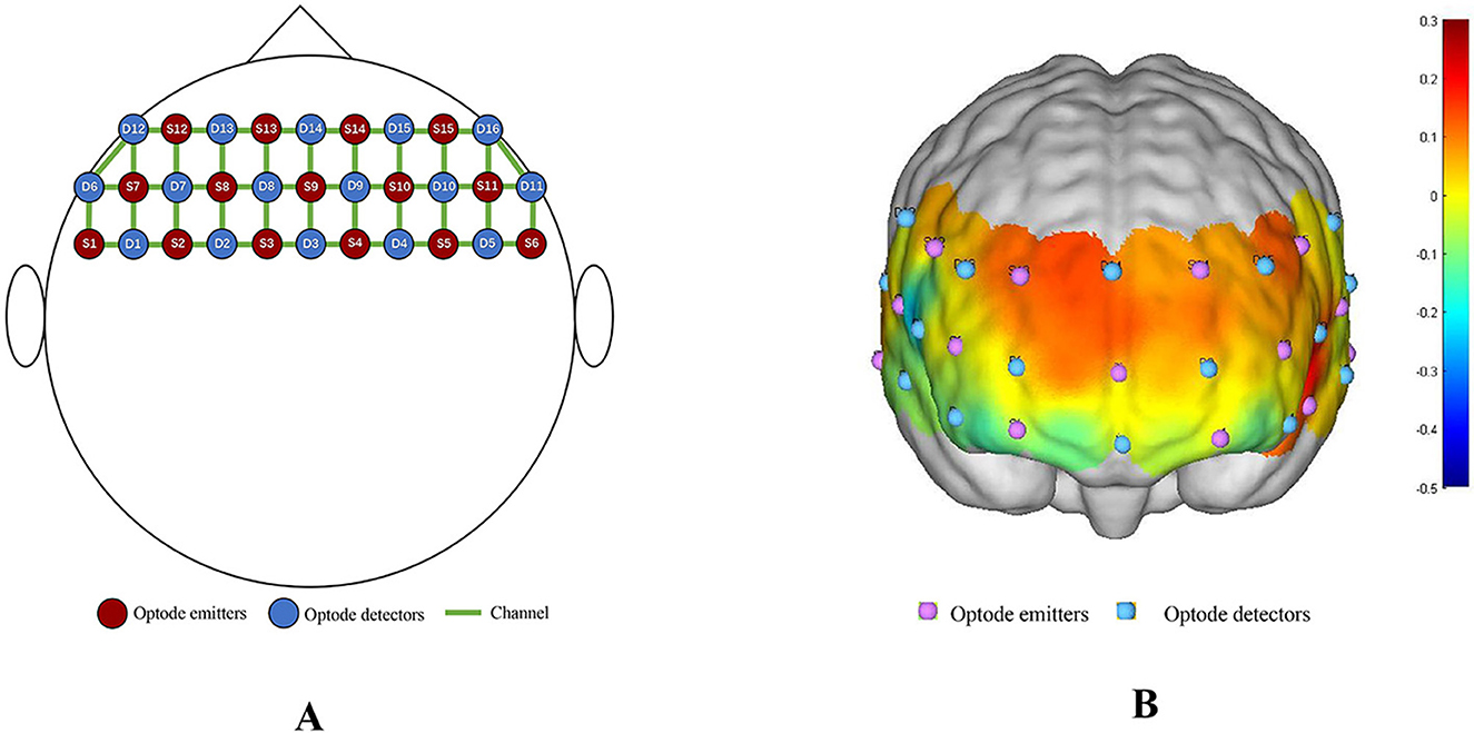 Schematic of optode placement and brain activation in functional neuroimaging. Panel A: Top-down view of scalp. 15 red light emitters (circular dots) and 16 blue light detectors (circular dots) are arranged in a grid, forming 48 measurement channels. Panel B: 3D brain model (top-down perspective). The cortical surface displays an activation heatmap, with red areas indicating high activation and blue areas indicating low activation. Red/blue dots correspond to emitter/detector positions from Panel A.