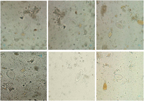 Microscopic images showing six panels of soil samples with varying densities of small, irregular particles. Oval structures are visible in some panels, possibly indicating biological specimens amidst the debris.