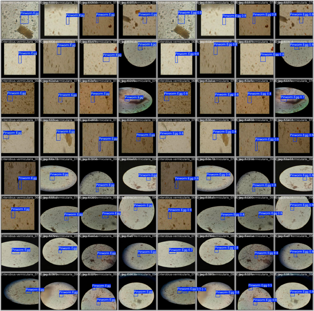 Microscope images showing various instances of a pinworm egg, identified and highlighted by blue rectangles in each frame. Labels with confidence scores accompany each highlighted area, with text reading