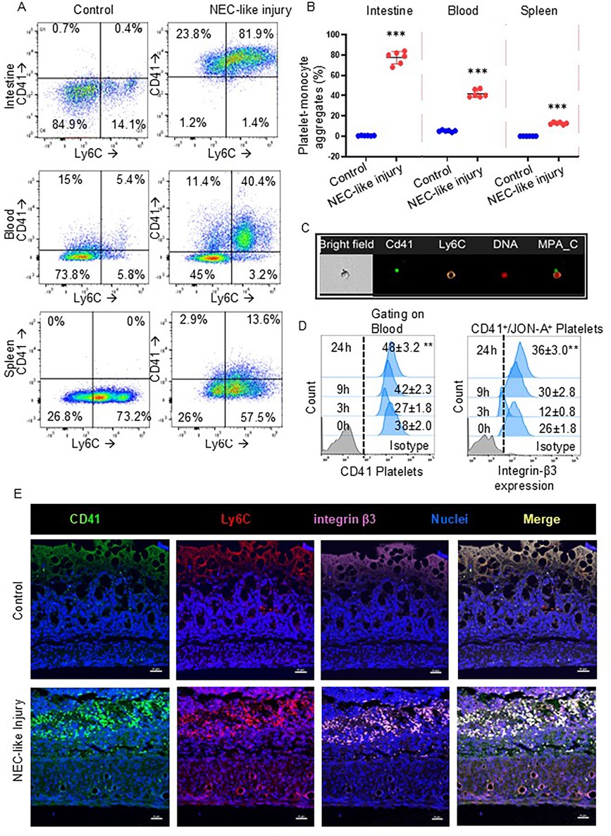 Flow cytometry analysis and microscopy images depicting platelet-monocyte aggregates and cellular markers in control versus NEC-like injury conditions. Scatter plots show CD41 and Ly6C expression in intestine, blood, and spleen. Bar graph compares aggregate percentages. Panel C presents different microscopy views. Panel D includes histograms of CD41 platelets and integrin-β3 expression. Panel E displays fluorescent staining of CD41, Ly6C, integrin β3, and nuclei in tissue sections, showing control and NEC-like injury comparisons with merged images.