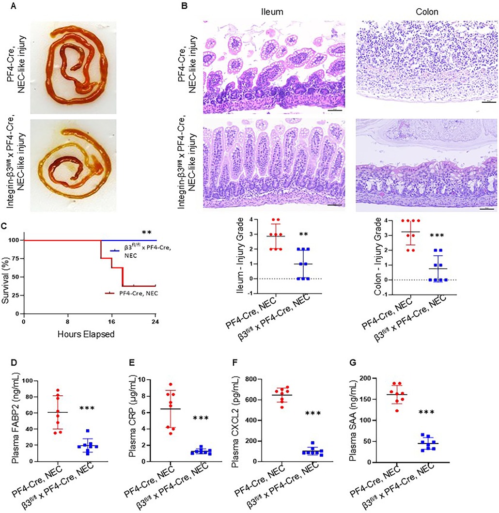 Panel A shows gross images of the intestine under two conditions: PF4-Cre, NEC-like injury, and Integrinβ3^fl/fl x PF4-Cre, NEC-like injury. Panel B illustrates microscopic images of the ileum and colon with NEC-like injury in both conditions, accompanied by graphs depicting injury grades. Panel C displays a survival curve comparing the two conditions over 24 hours. Panels D to G feature bar graphs comparing plasma levels of FABP2, CRP, CXCL2, and SAA, respectively, with significant differences indicated by asterisks.