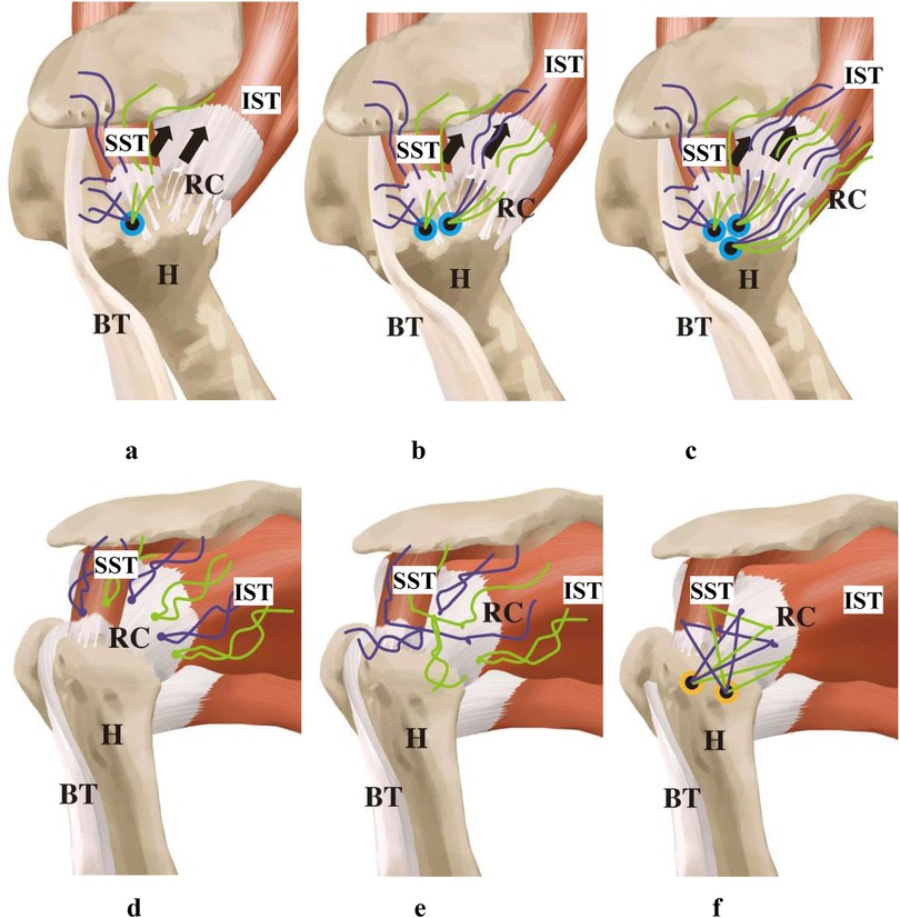 Illustrations of the shoulder joint showing anatomical structures. Panels a to f depict different angles and layers, highlighting muscles and tendons labeled SST, IST, RC, and bones labeled H and BT. Multicolored lines indicate muscle fiber directions