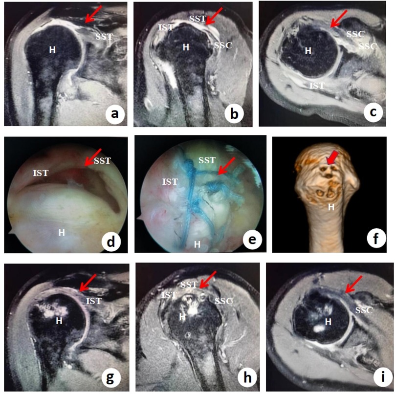 Nine-panel image showing various diagnostic images of a shoulder joint marked