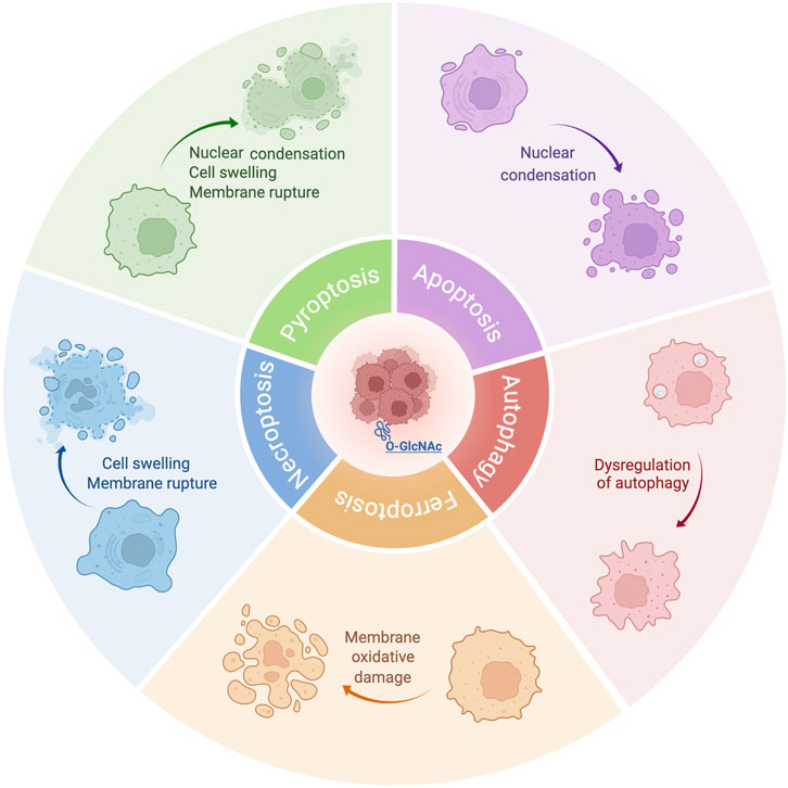 Illustration of different types of cell death labeled as Pyroptosis, Apoptosis, Autophagy, Ferroptosis, and Necroptosis, positioned around a central cell. Each section describes related processes: nuclear condensation, cell swelling, membrane rupture, oxidative damage, and autophagy dysregulation. A central cell image includes the label