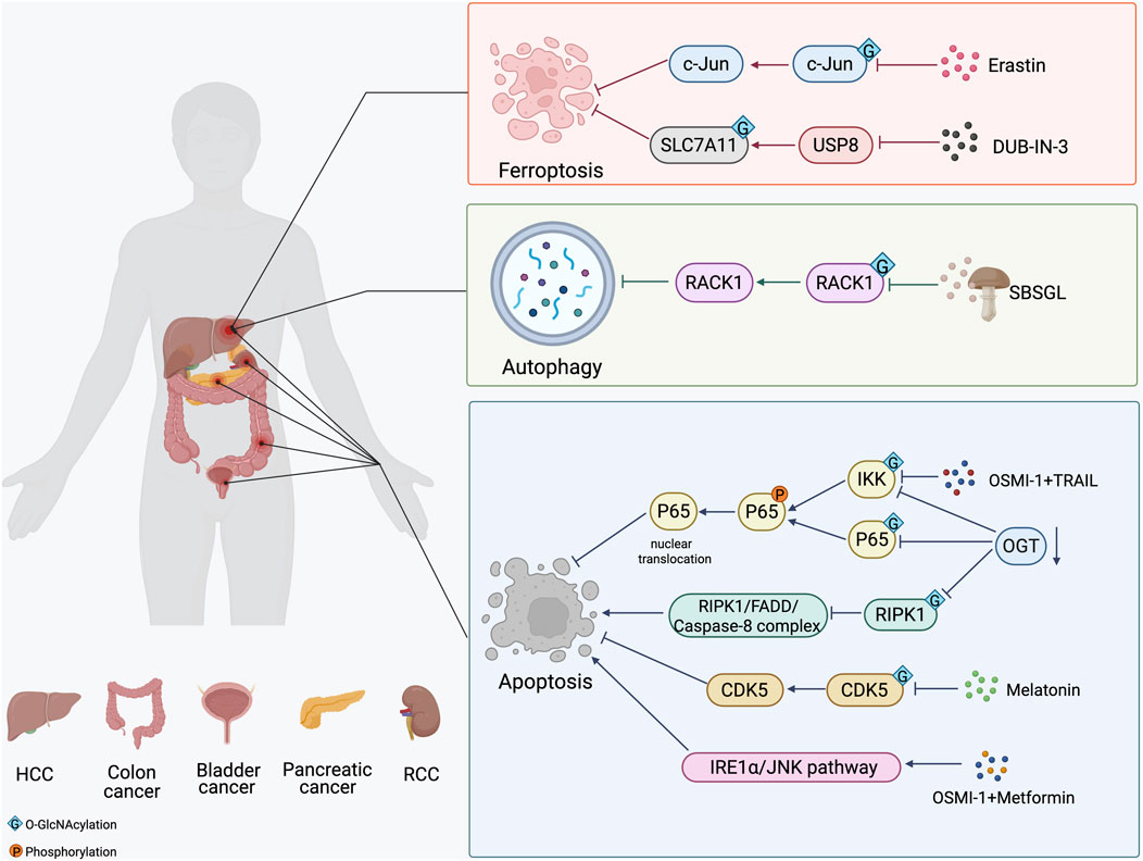 Diagram illustrating pathways involved in cancer processes. It shows three main pathways: Ferroptosis, Autophagy, and Apoptosis. The Ferroptosis pathway involves c-Jun with Erastin and SLC7A11 with DUB-IN-3. Autophagy involves RACK1 influenced by SBSGL. Apoptosis shows P65, IKK, RIPK1, CDK5, and IRE1α/JNK pathway, influenced by molecules like OSMI-1, TRAIL, OGT, and Melatonin. A body silhouette highlights liver, colon, bladder, pancreas, and kidney in relation to cancer types. O-GlcNAcylation and Phosphorylation are noted as specific modifications affecting pathways.