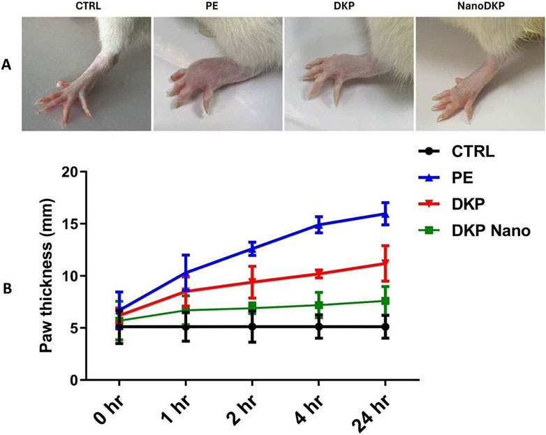 Four images display animal paws treated with different substances (CTRL, PE, DKP, NanoDKP). Below is a line graph showing paw thickness over time (0 to 24 hours) for each treatment. CTRL remains constant, while PE shows the most increase, followed by DKP and NanoDKP. Legend identifies each treatment with specific colors and symbols.