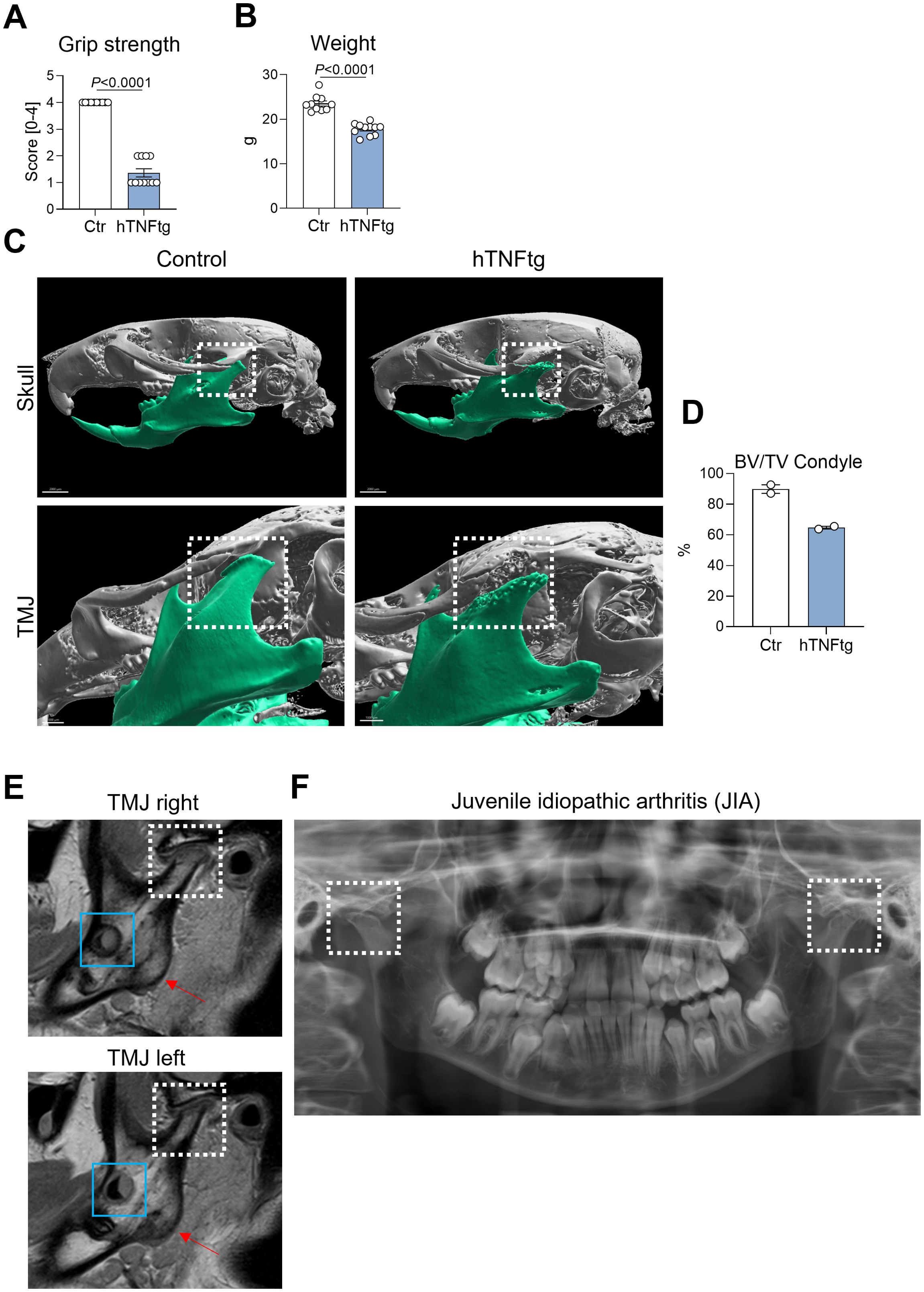 Graphs and images showing comparisons between Control and hTNFtg subjects. Chart A illustrates grip strength, showing significantly lower scores for hTNFtg. Chart B displays weight differences, with lower values for hTNFtg. Part C presents skull and TMJ images highlighting structural differences. Chart D shows BV/TV condyle percentages, lower in hTNFtg. Images E and F depict TMJ scans with marked areas for Juvenile Idiopathic Arthritis examination.