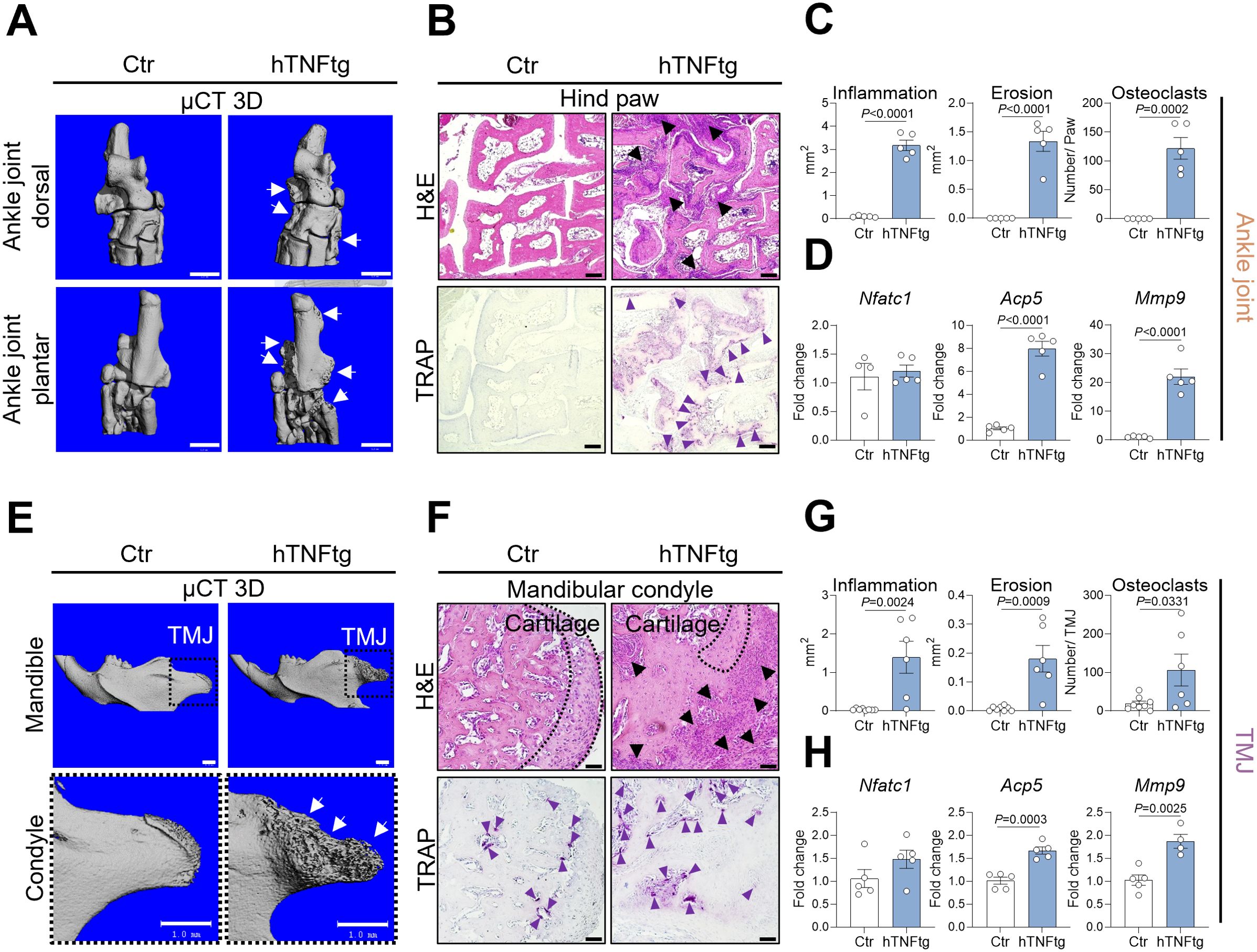 Panels compare control and hTNFtg groups through various analyses. Panel A: Micro-CT 3D images of dorsal and plantar ankle joints with arrow indications. Panel B: Hind paw histology with H&E and TRAP staining showing differences. Panel C: Bar graphs displaying inflammation, erosion, and osteoclast data with statistical significance. Panel D: Gene expression fold change graphs for Nfatc1, Acp5, and Mmp9. Panel E: Micro-CT 3D images of mandible and condyle with markers. Panel F: Histology of mandibular condyle with H&E and TRAP staining. Panel G: Bar graphs for inflammation, erosion, and osteoclast data at TMJ with significance. Panel H: Gene expression fold change graphs for Nfatc1, Acp5, and Mmp9 at TMJ.