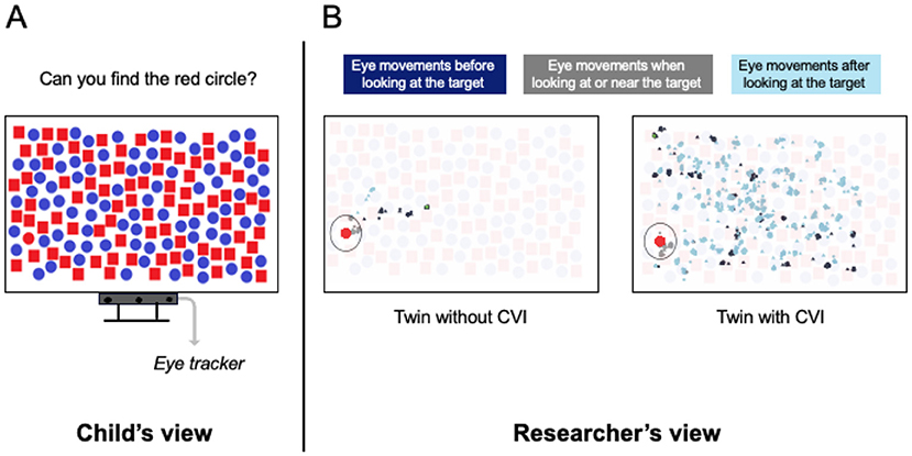 Panel A shows a child’s view during an eye tracking search task. The search display shows red squares, blue circles and one red circle (target). The eye tracker is placed underneath the display. Panel B illustrates the researchers view during the same search task. The left graph shows a twin without CVI, who needs few eye movements to find the target. the right graph shows the twin with CVI, who needs a lot of eye movements all over the display to find the target.