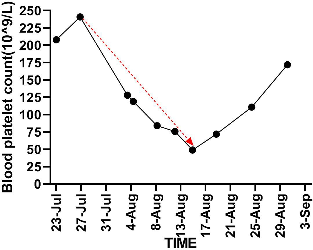 Line graph showing blood platelet count over time from July 23 to September 3. Initial count is 200, sharply decreasing to a low on August 13, then gradually rising again, with a significant drop noted by a red arrow.