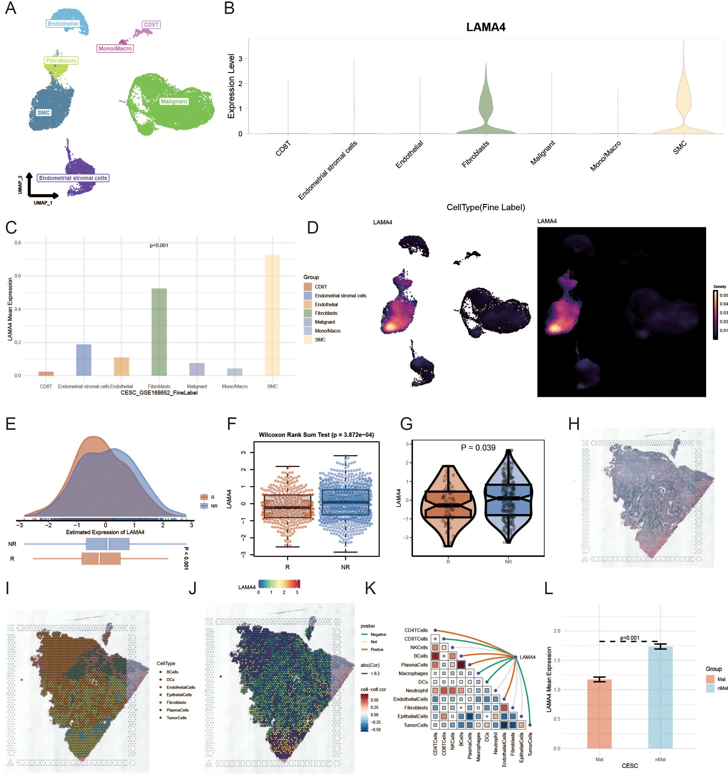 A series of charts and plots presenting data on gene expression levels among different cell types, focusing on LAMA4. Panel A shows a UMAP clustering of cell types. Panel B displays LAMA4 expression as violin plots. Panel C shows a bar graph of LAMA4 mean expression across cell groups. Panel D includes spatial plots with expression gradients. Panel E presents a density plot and box plot of LAMA4 expression. Panel F features a box plot with p-value annotation. Panel G shows a violin plot with overlap of R and NR groups. Panels H, I, and J include histopathology images and cell type maps. Panel K features a correlation matrix, and Panel L displays a bar graph comparing LAMA4 expression levels in two groups.